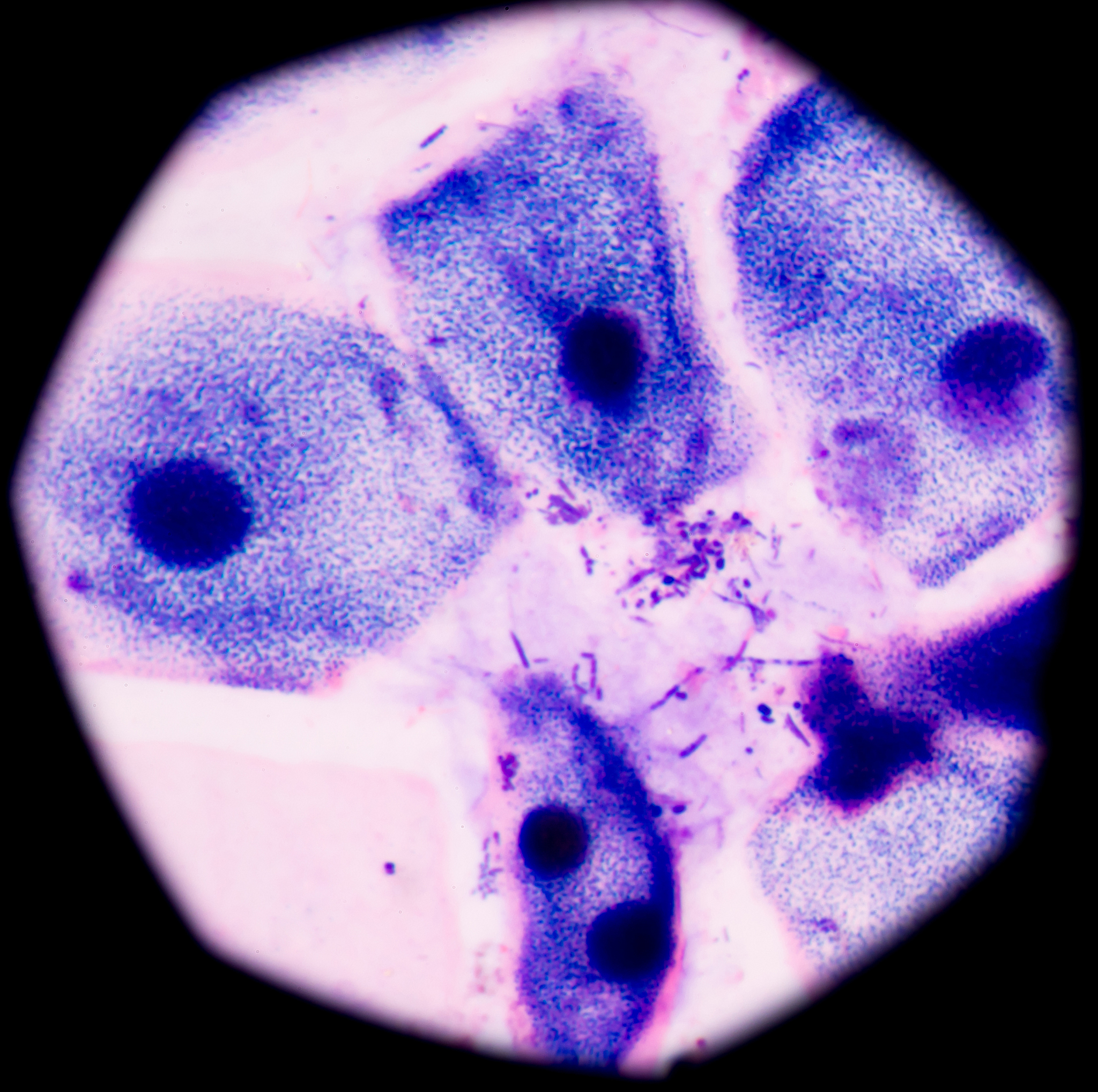 试述口腔黏膜上皮细胞的种类及部位分布、排列特点