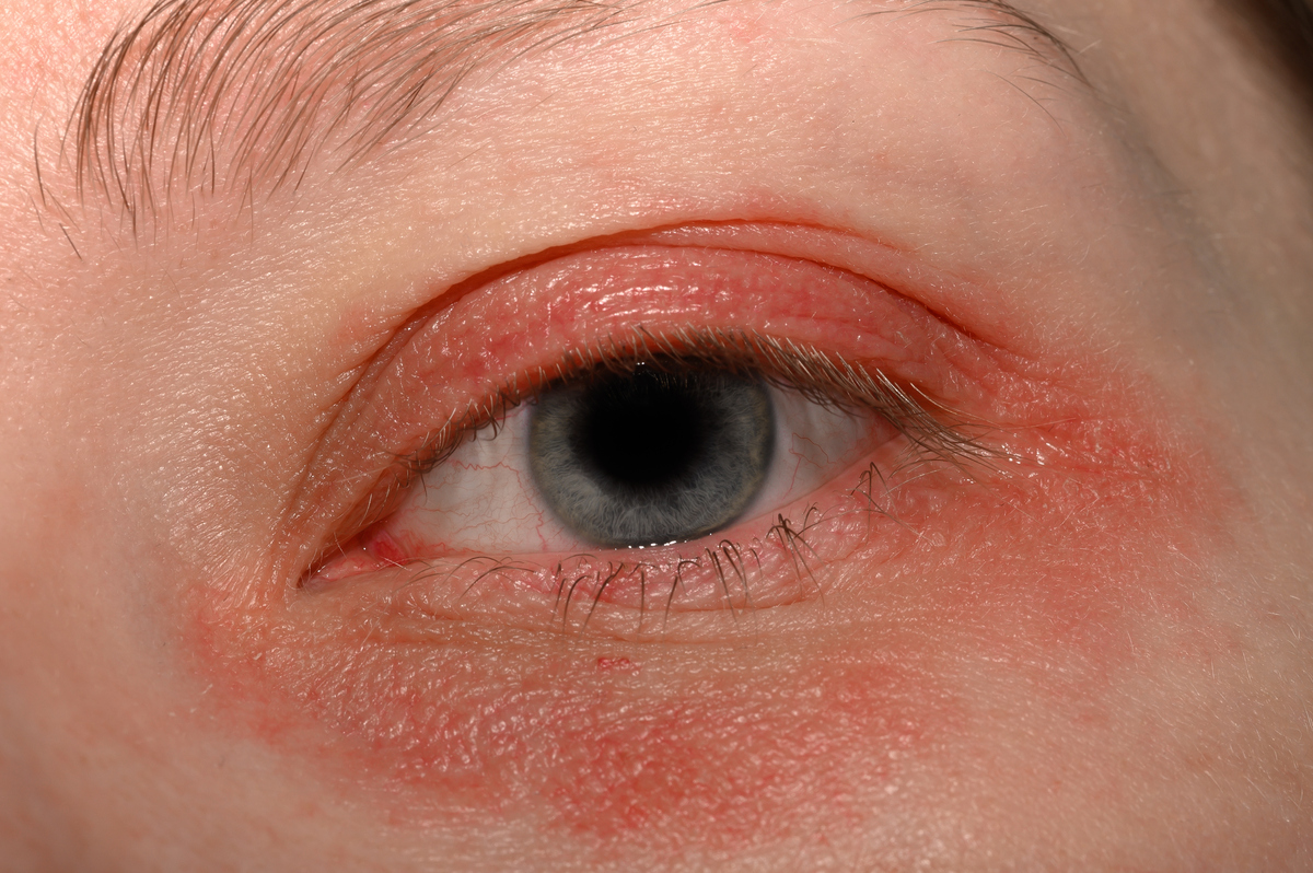 右眼皮一直跳？可能的原因和应对措施