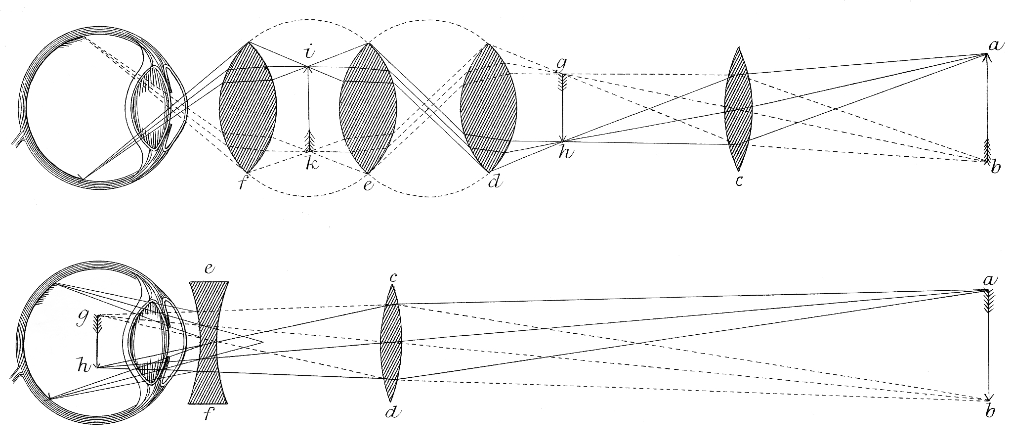 凸透镜增亮优化方案：提升亮度的方法和技巧