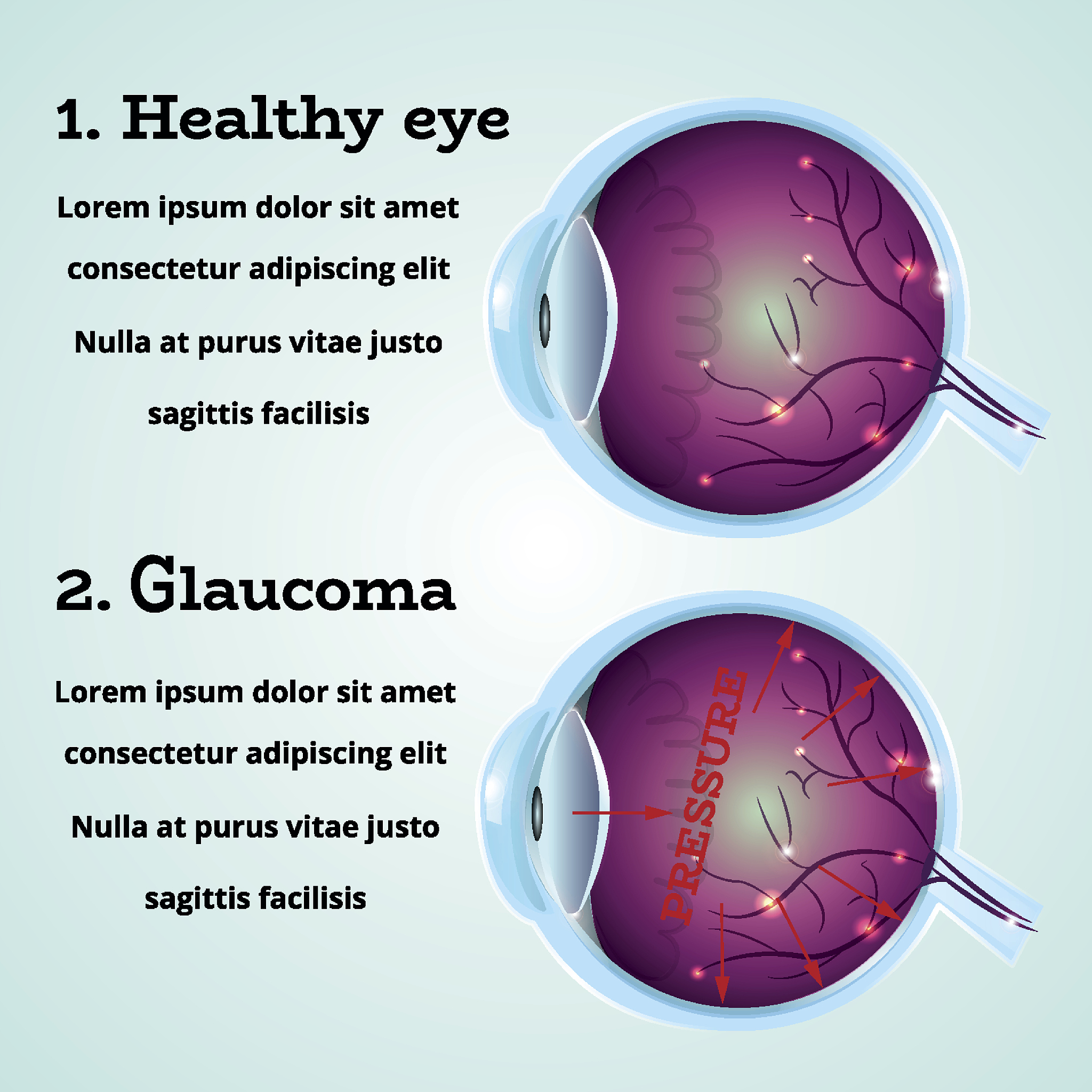 RB基因发现于哪种肿瘤？