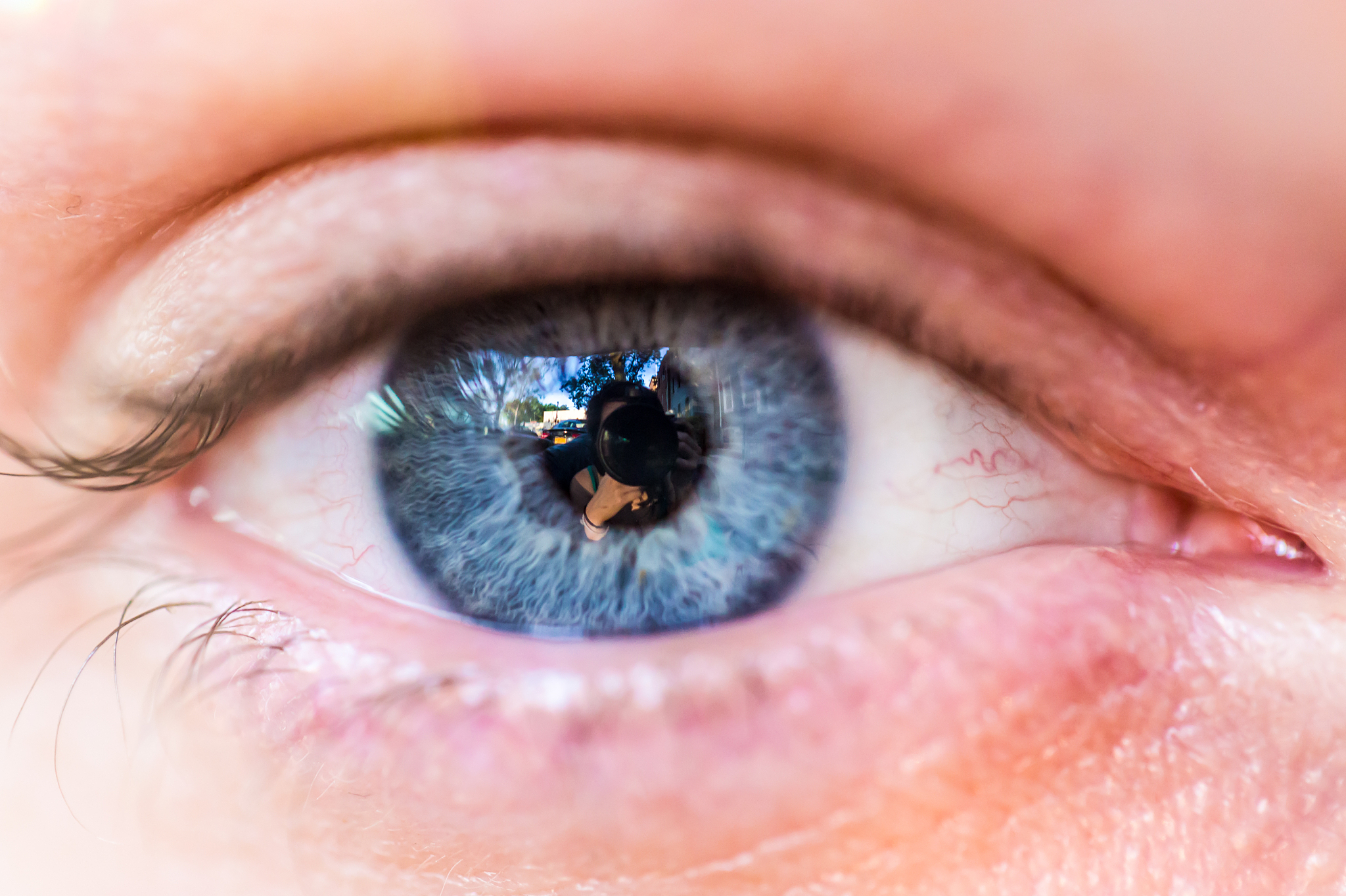 eye voltage