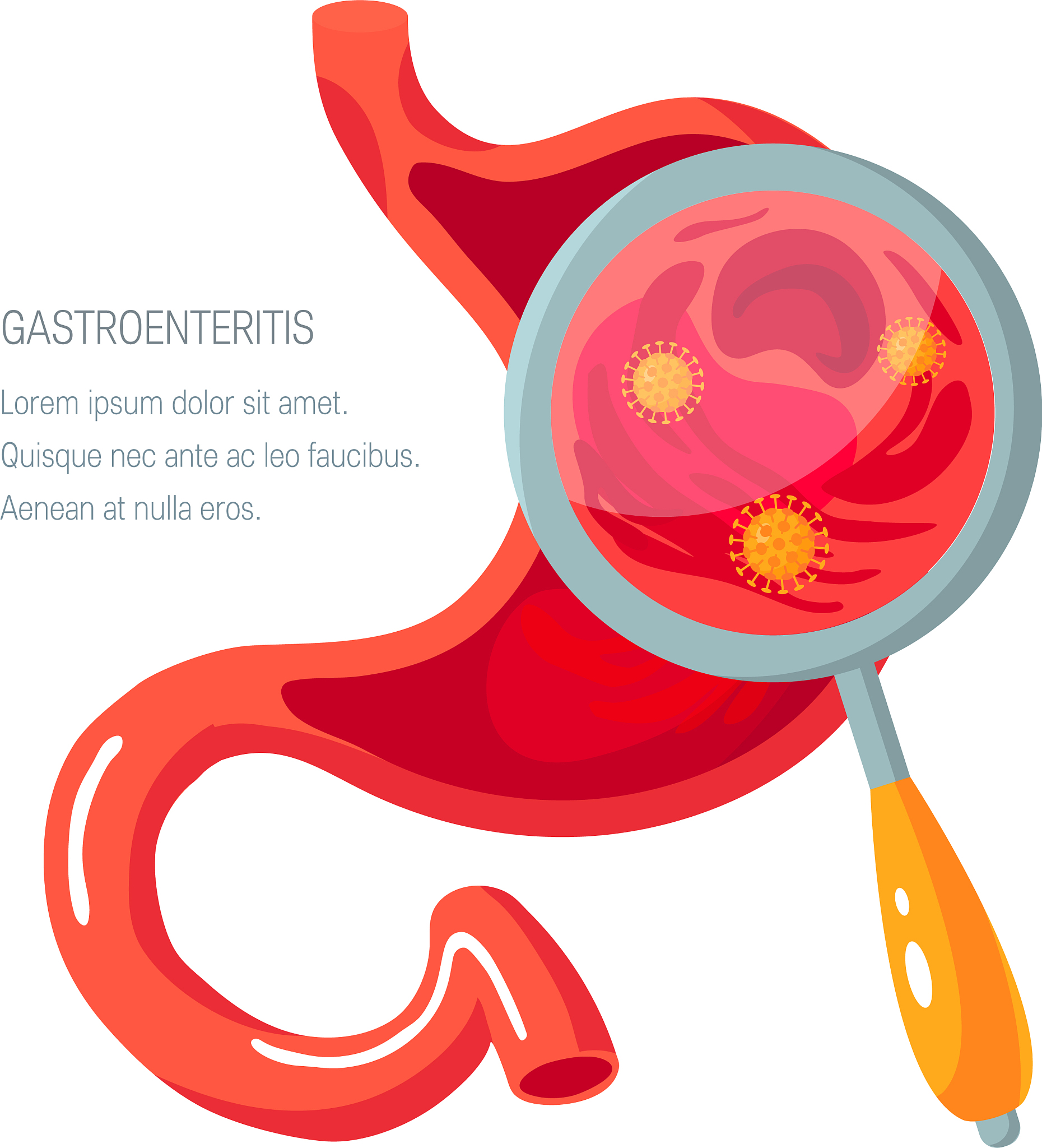 幽门螺杆菌科普：全面解析，彻底了解它的真相！