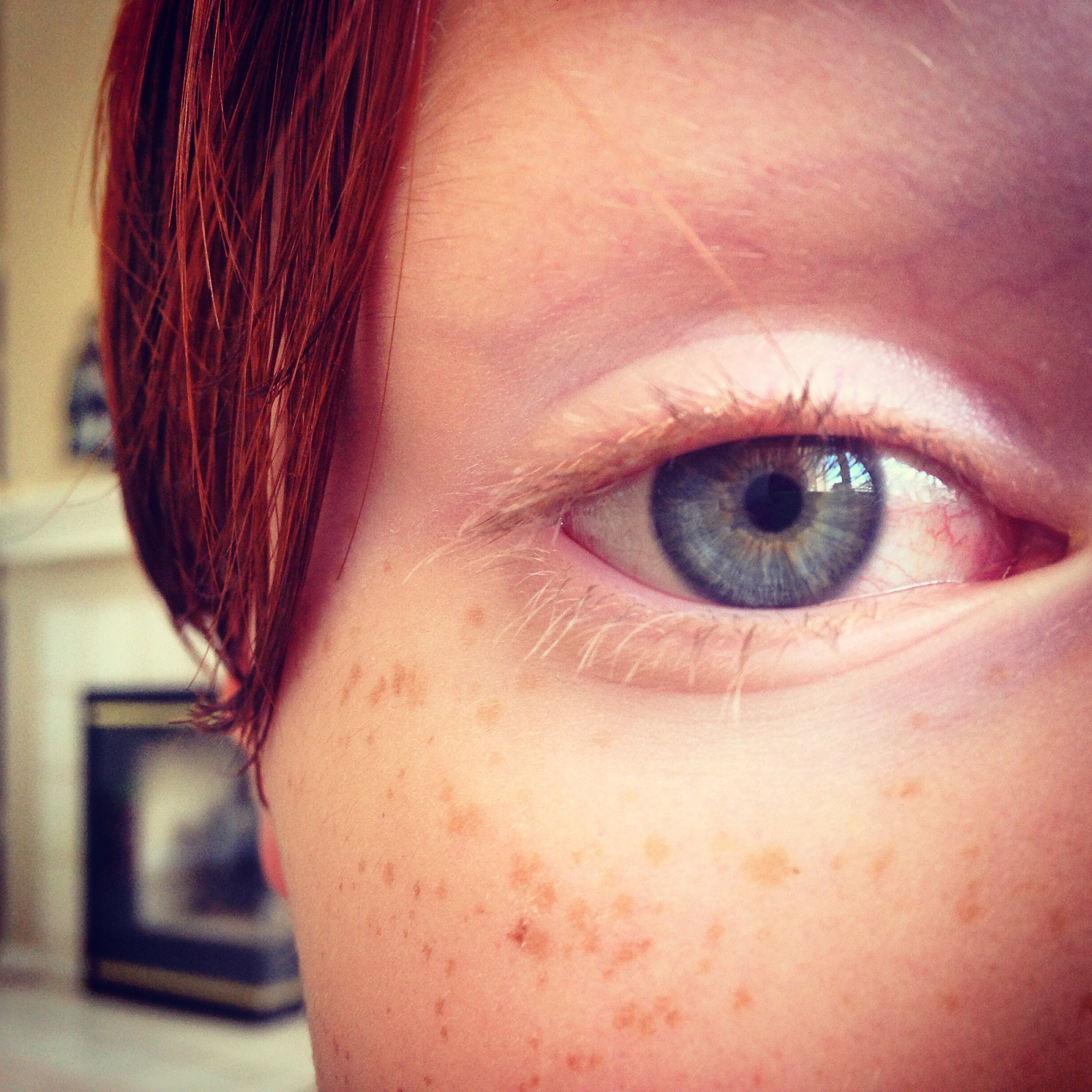 凸眼可以吃什么药