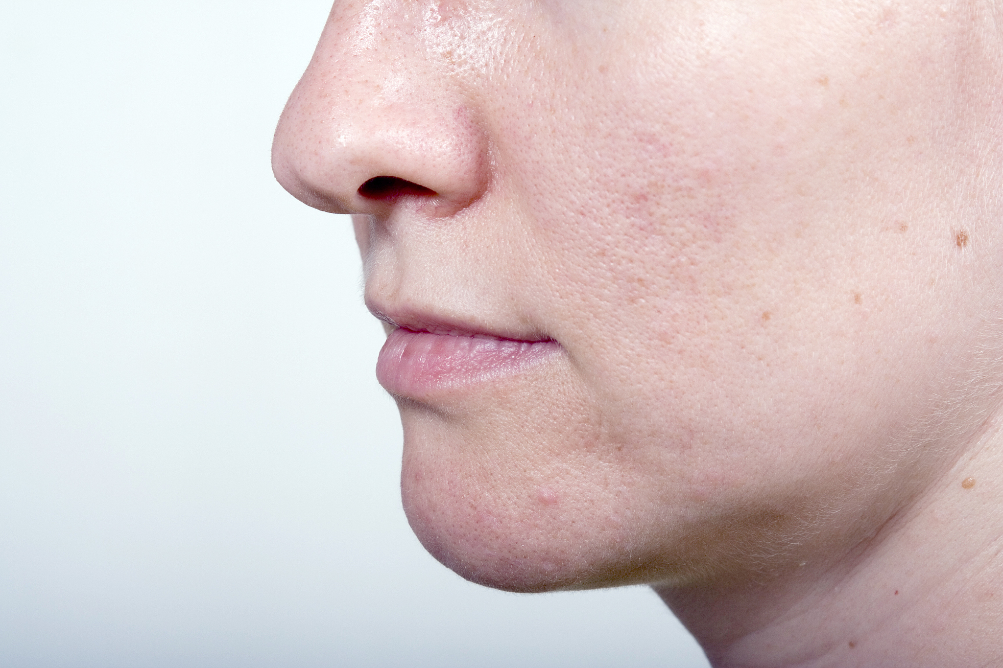 摆脱痘坑，找寻真爱：自信魅力的修炼之道