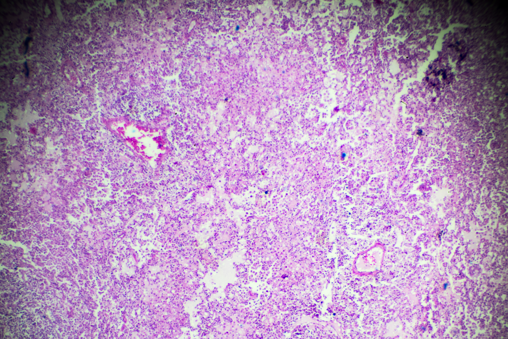 请帮我详细说明以下这篇文献并仔细解释其实验方法Caspase-411–MediatedPulmonaryArteryEndothelialCellPyroptosisContributestoPulmonaryArterialHypertension