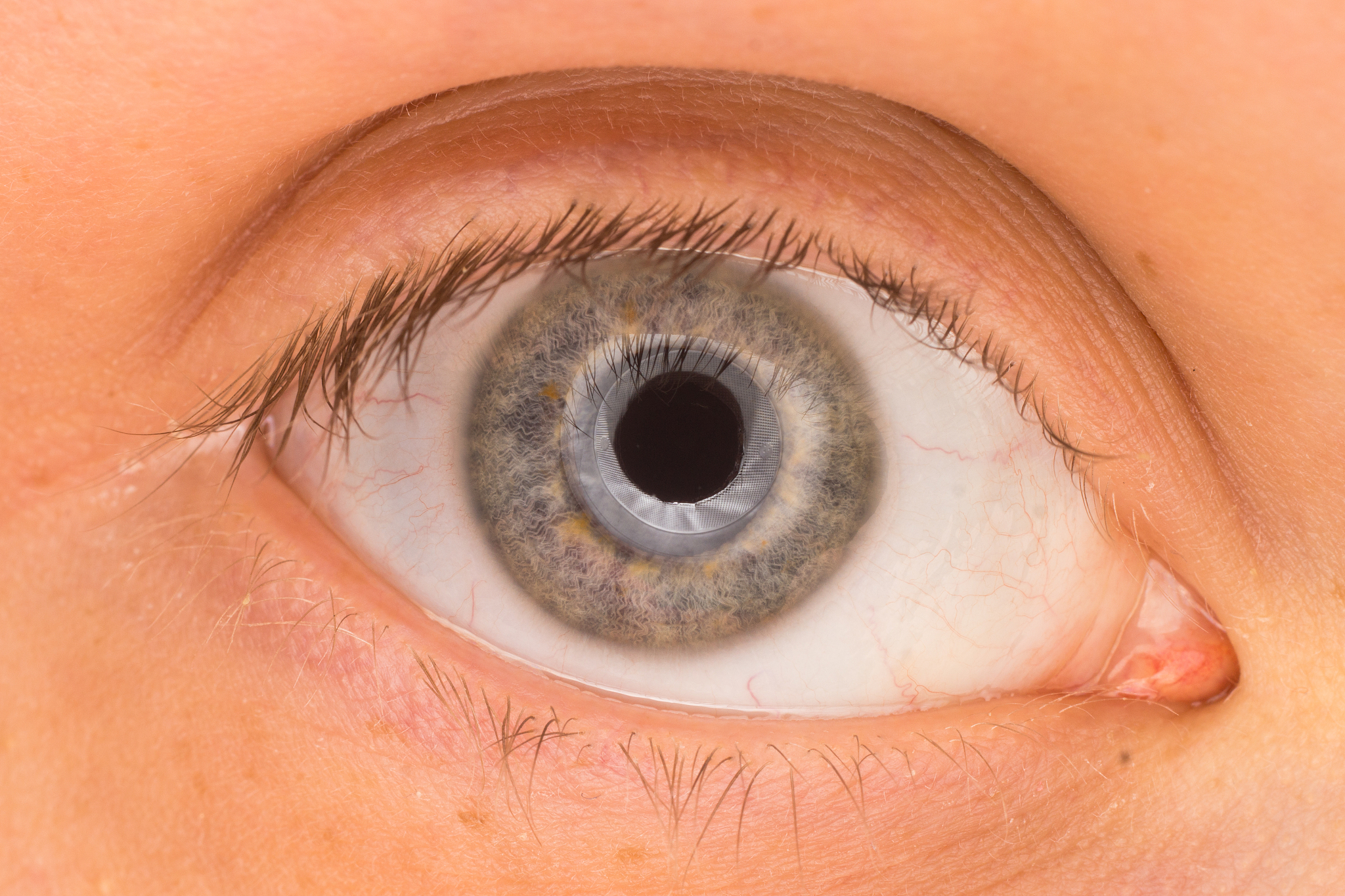 grey eye