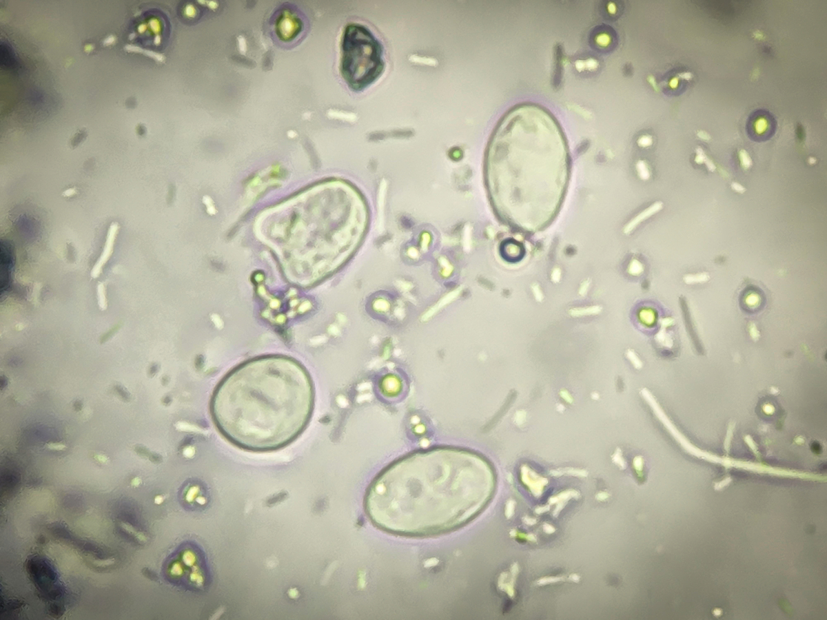 类鼻疽伯克霍尔德菌：致病菌，症状，治疗和预防