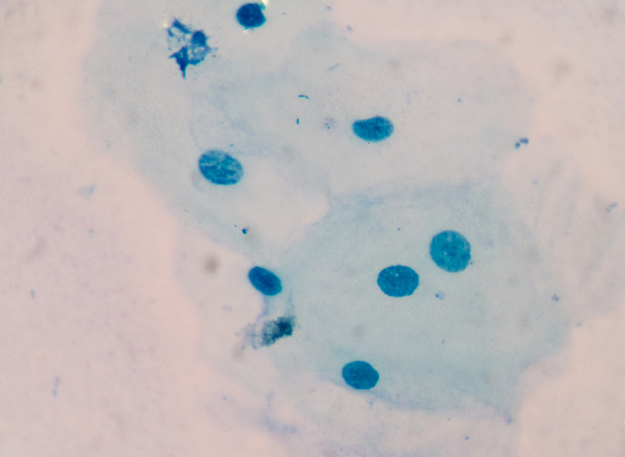 tissue epithelial cells.