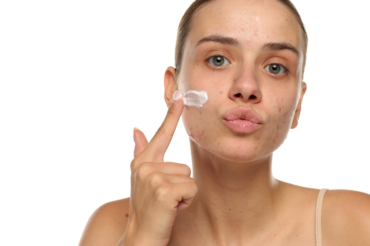 长痘应该怎么办