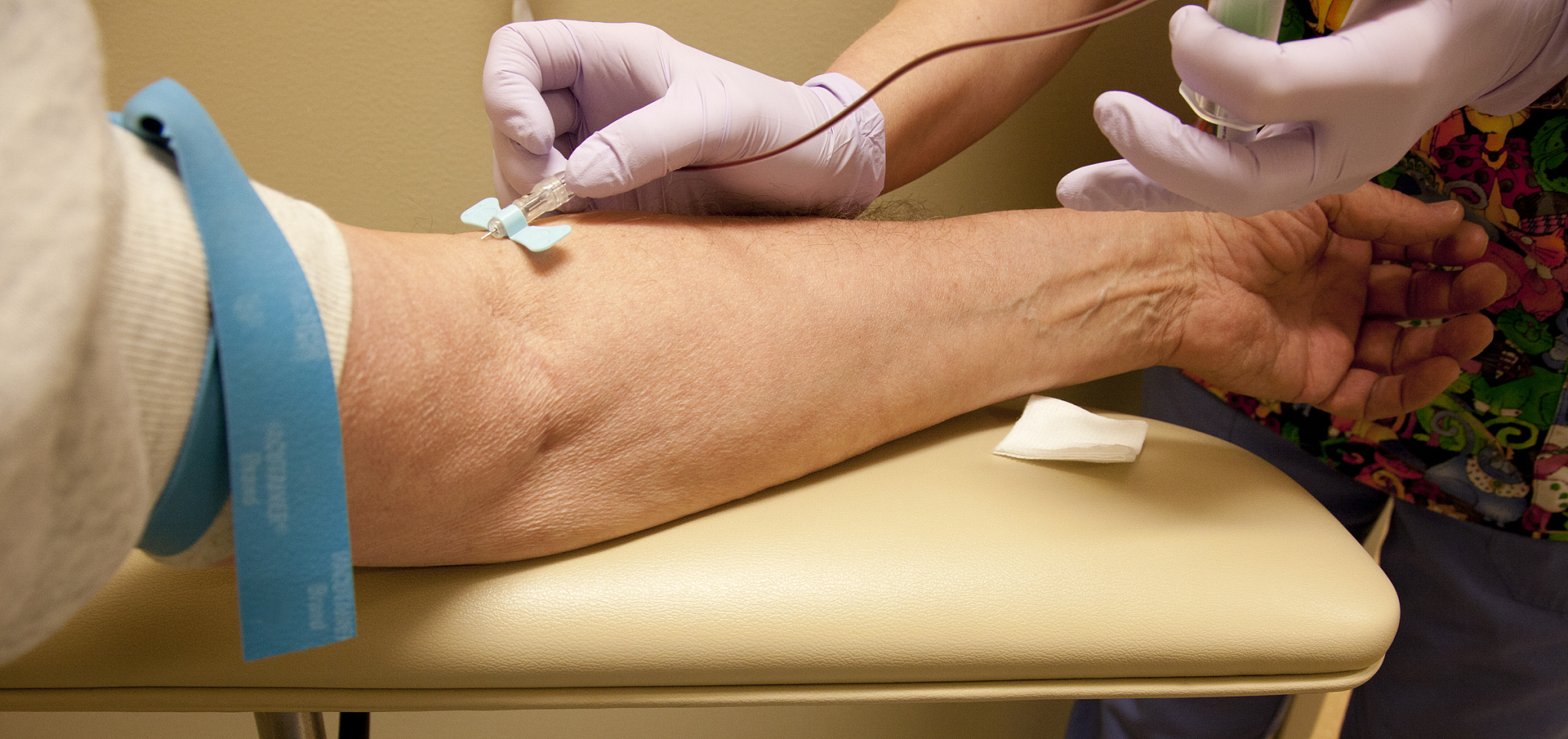 祝福杰哥腿部矫正手术顺利！