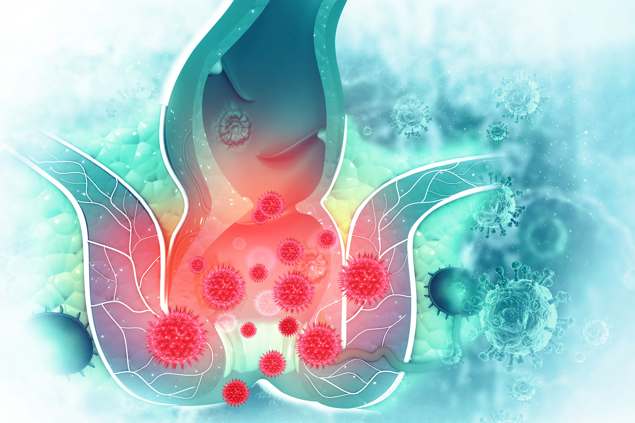haemorrhoids disease (piles) on scientific background. 3d illust