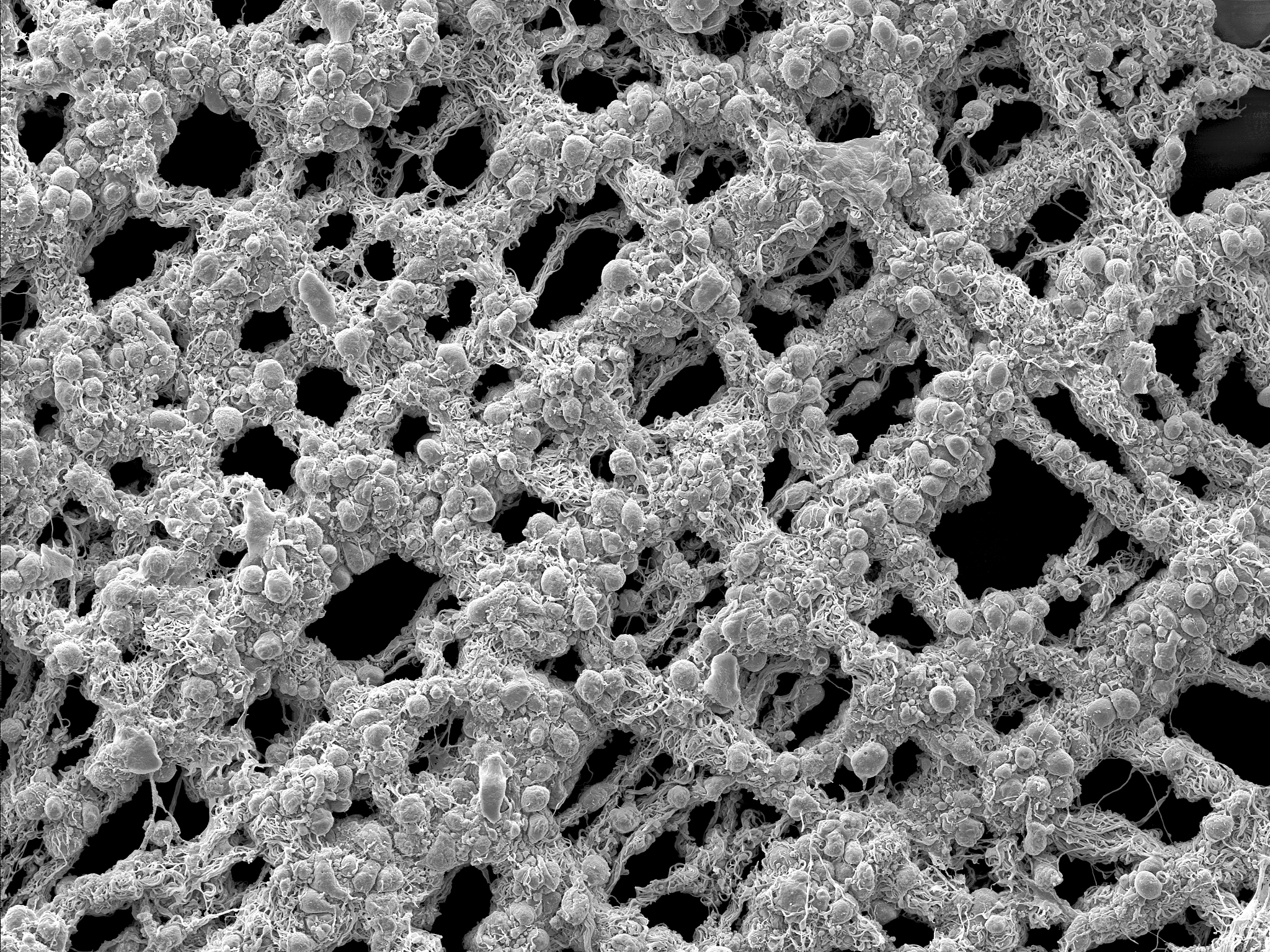 扫描电镜：原理、使用方法和应用 - 探索微观世界