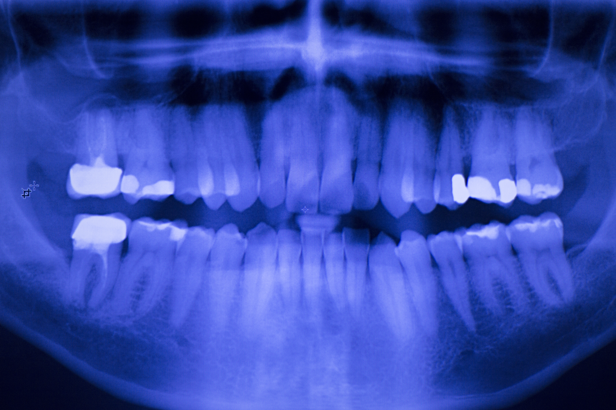 昆明医科大学口腔医学专业：实力雄厚，培养口腔医学人才