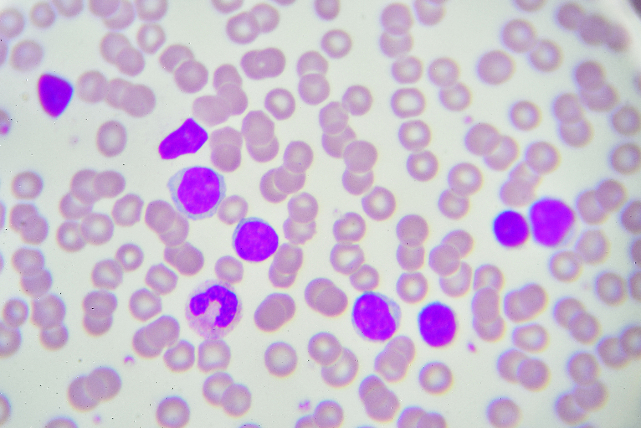 免疫组织化学染色