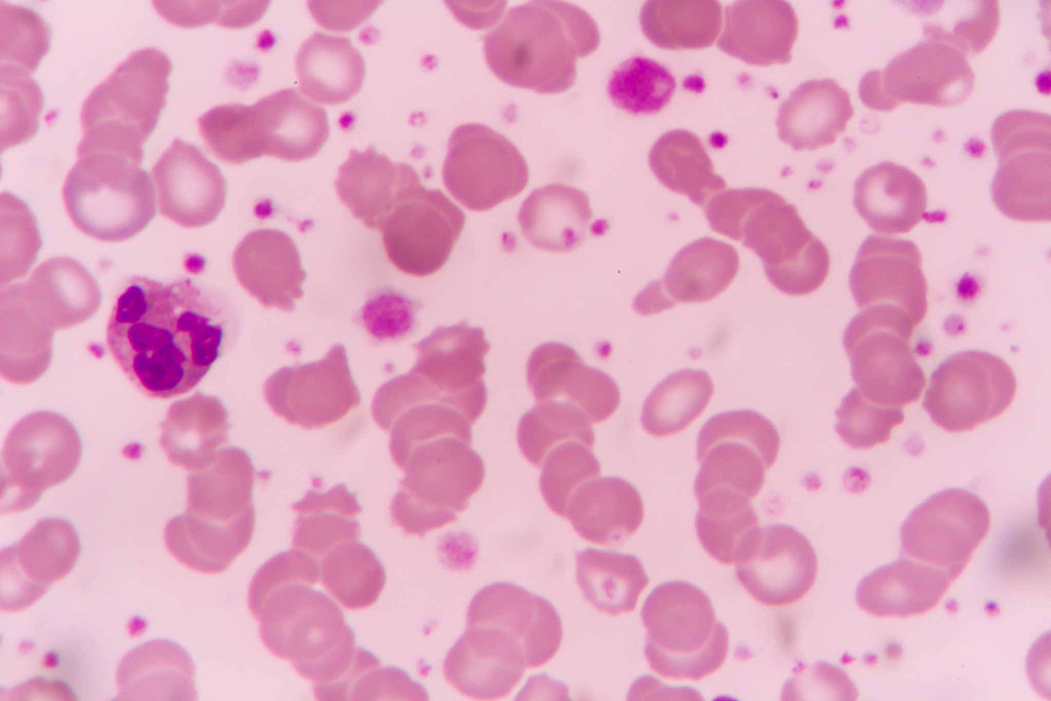 血常规里有哪些指标可以证实可能是病毒感染？