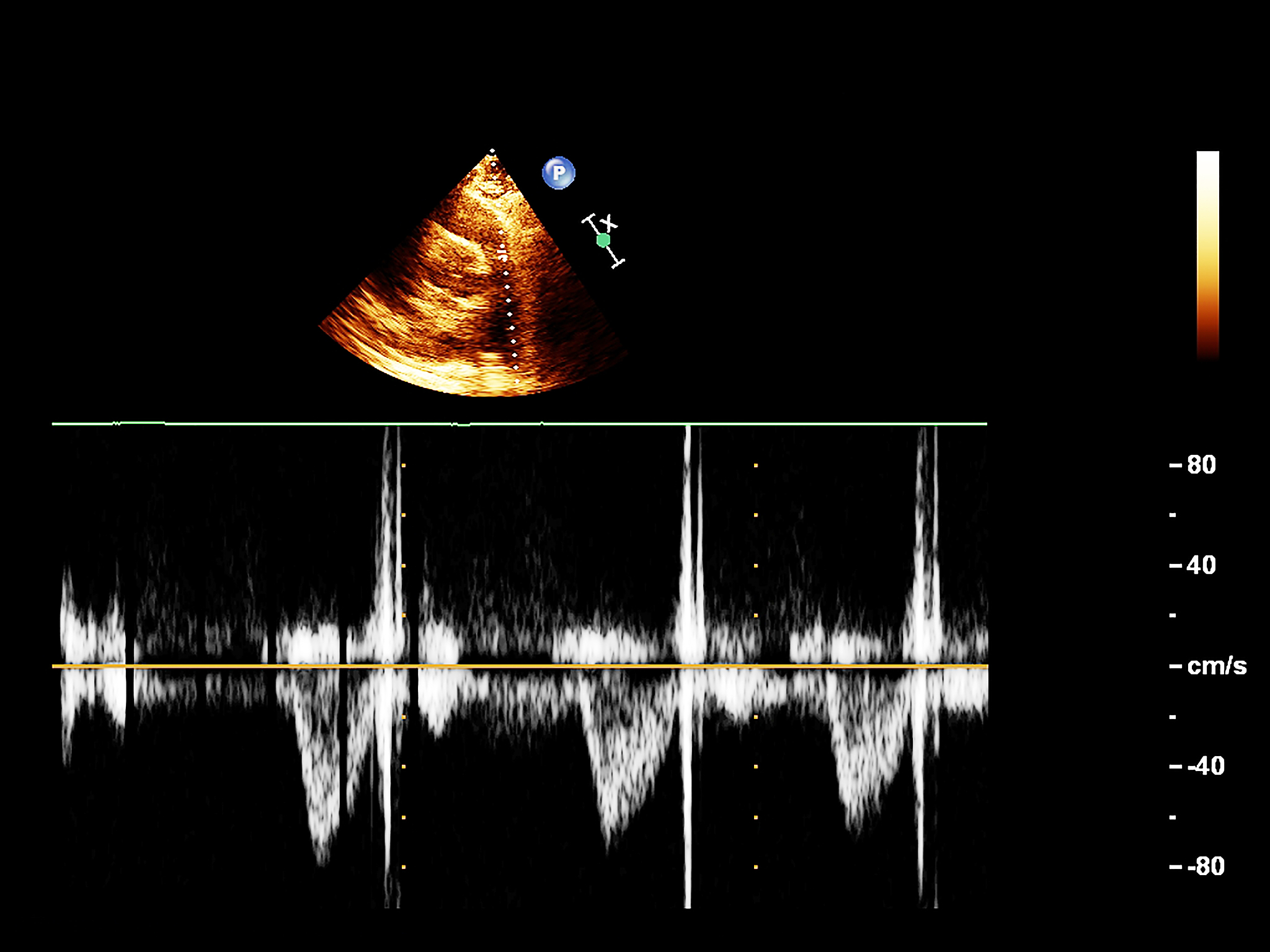 激光超声技术约束效应：增强检测效果和信号强度