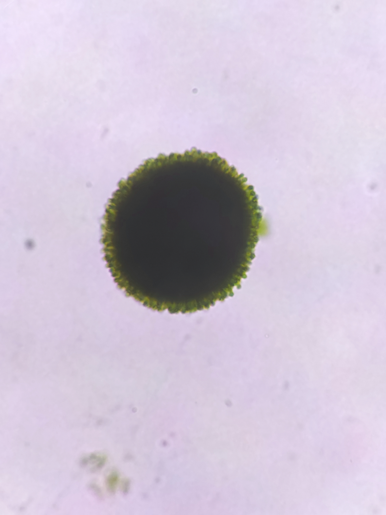 以四年级学生小明的口吻写一篇900字记叙文题为《最难忘、最严重的两次拉肚子》讲述他一年级时感染蓝氏贾第鞭毛虫拉肚子1个星期和幼儿园时感染轮状病毒5天的经历注意要描写拉肚子时的痛苦感受。一年级时详写第一天时上语文课憋不住拉肚子拉出来晚上拉肚子10几次；幼儿园时详写第一天时吃中饭时憋不住拉肚子拉出来晚上拉肚子10几次。将每次经历至少450字写详细。