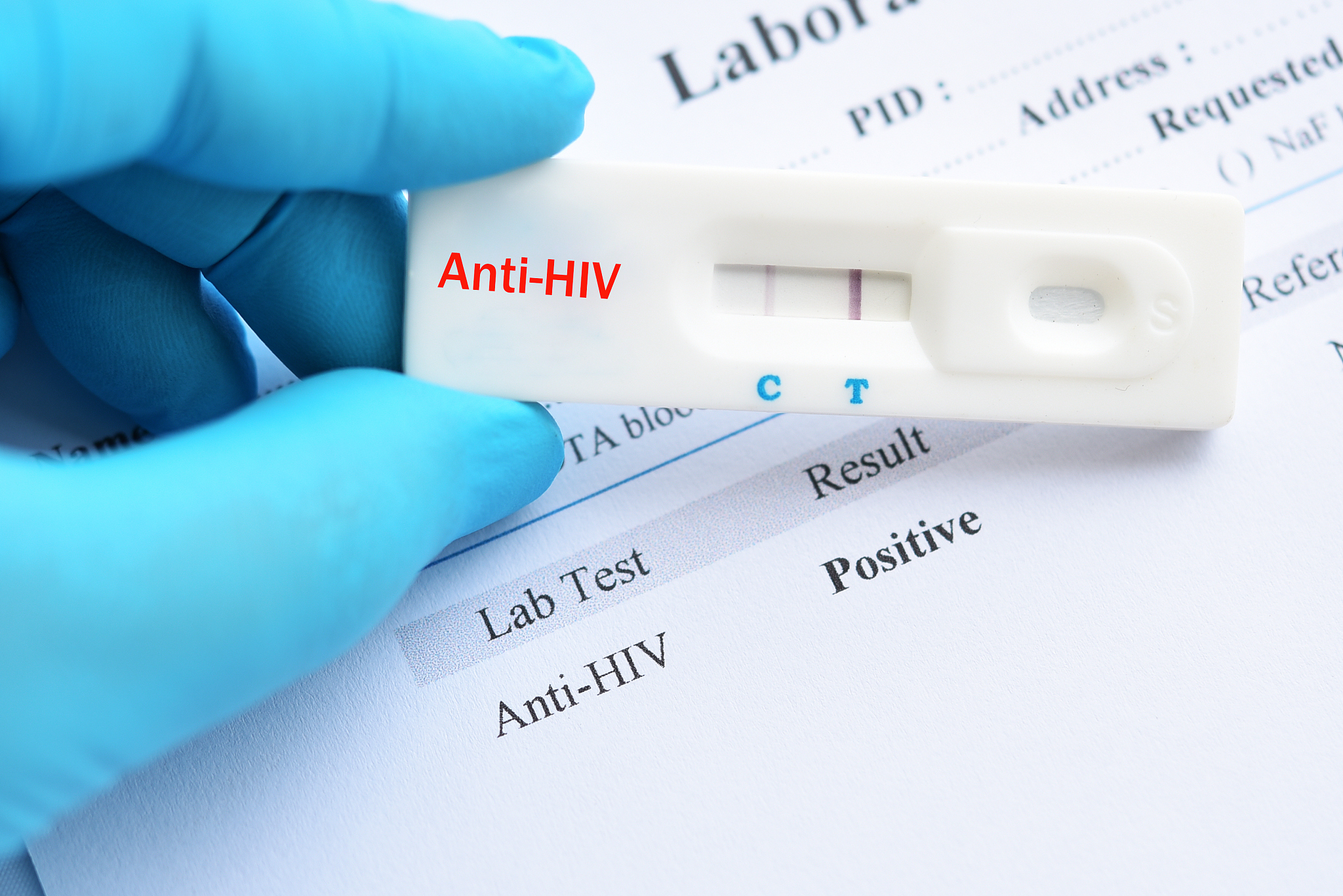 HIV感染者ICIS前精液优化处理：与非感染者区别？