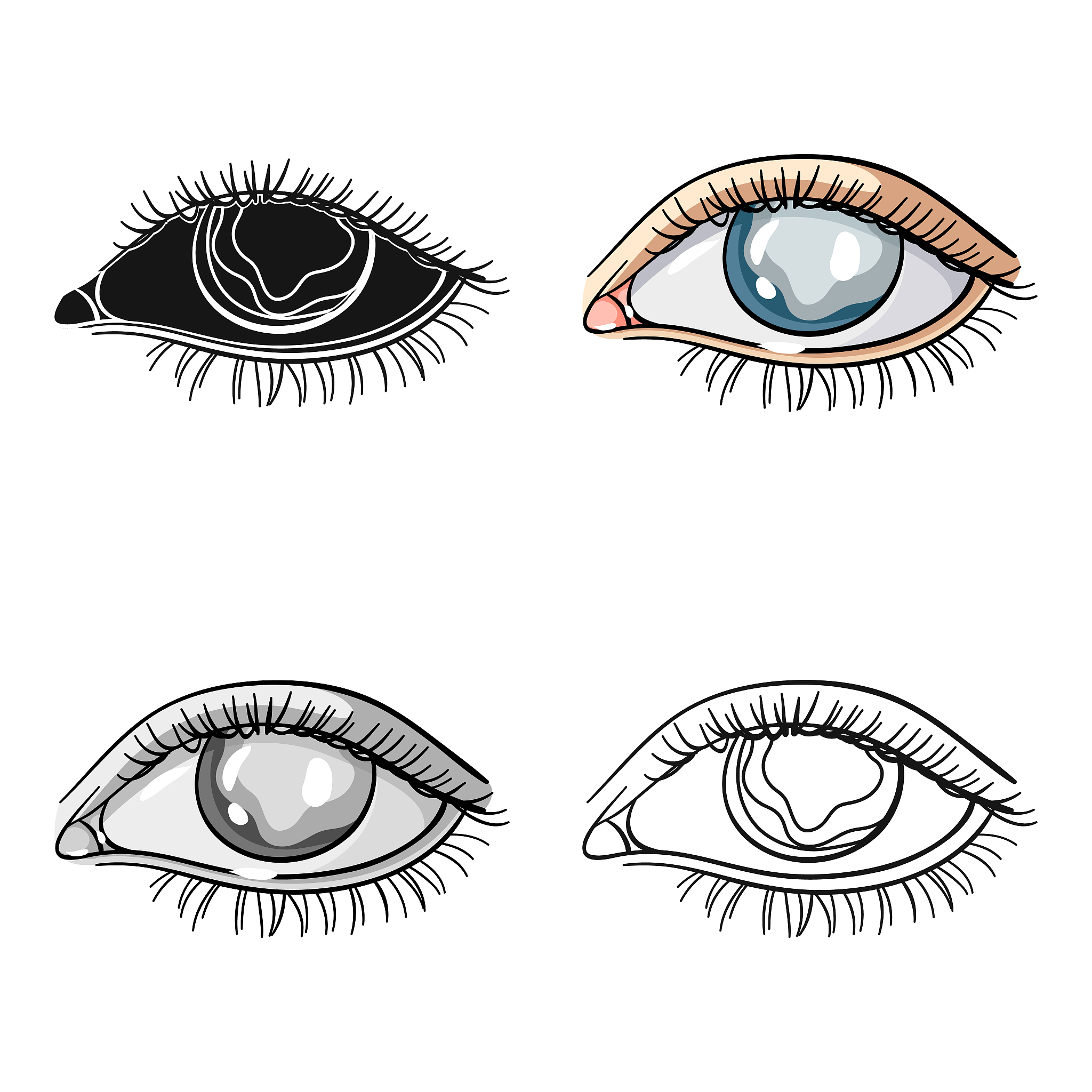 眼睑痉挛：症状、原因、类型及治疗方法