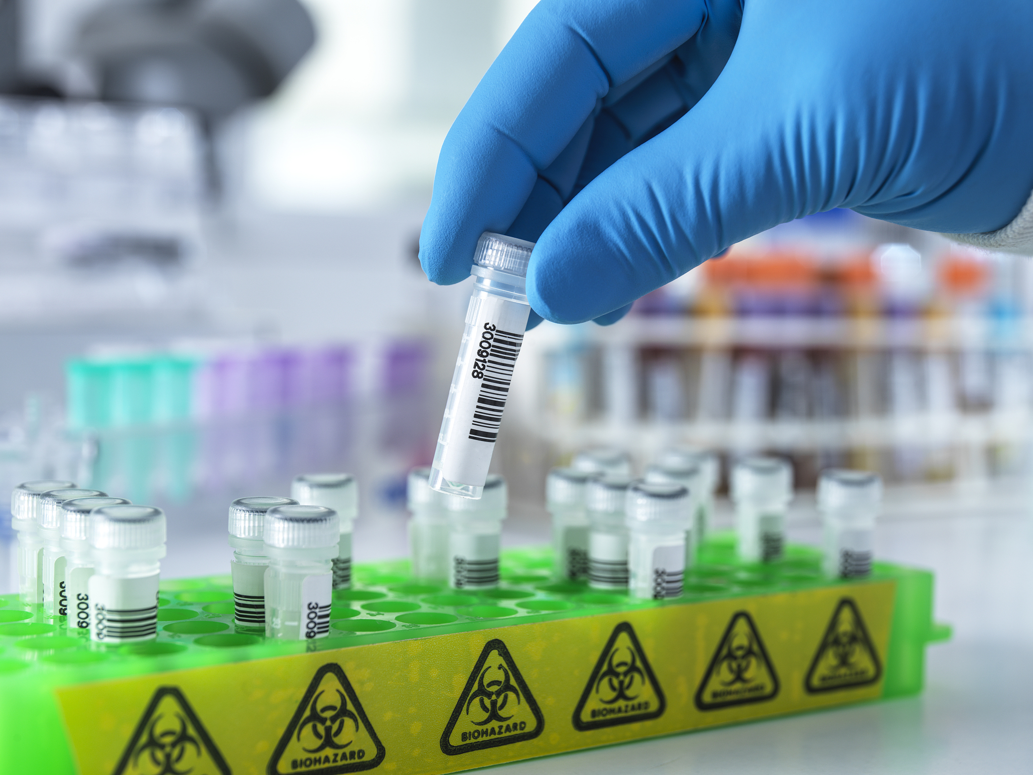 不做药敏试验的风险：感染治疗失败、耐药性增加