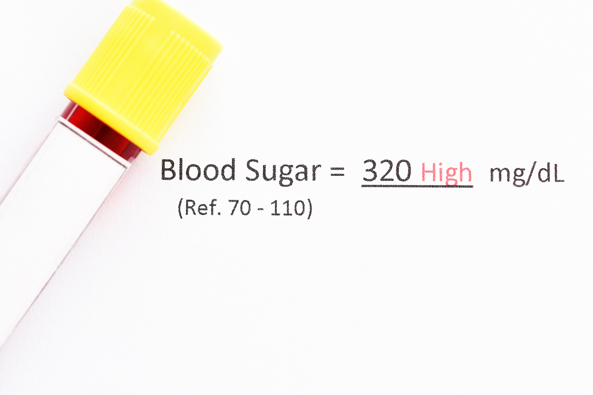 你好我要写一个实验报告请你帮我可以吗？当然可以您需要什么帮助？#标题 实验报告人 实验目的 实验步骤重要前期准备培养基灭菌等过程使用器材药品操作等 实验结果描述菌落形态大小分布等等 讨论分析