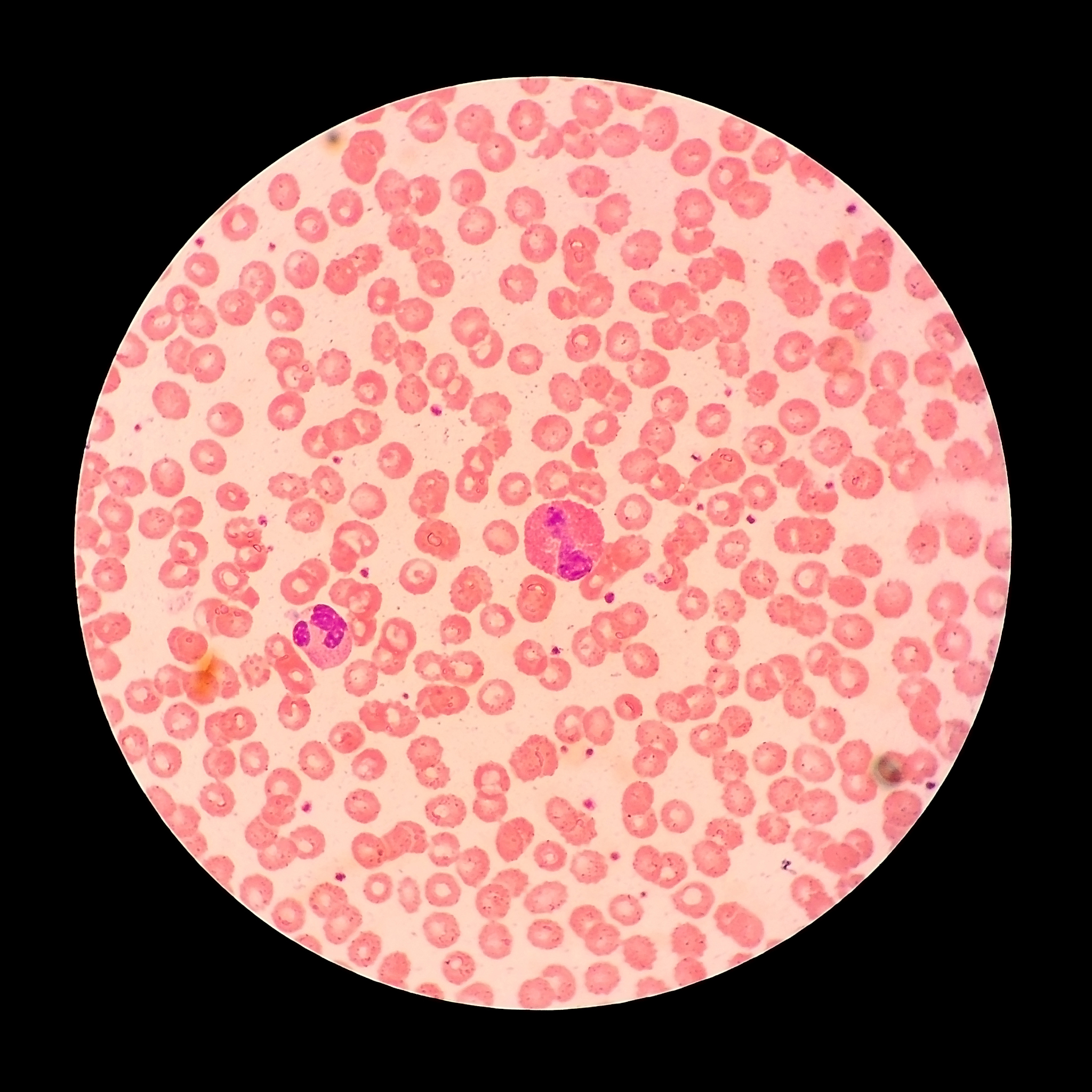 三门峡市卫生学校医学检验技术专业招生：3年学制，培养医学检验人才