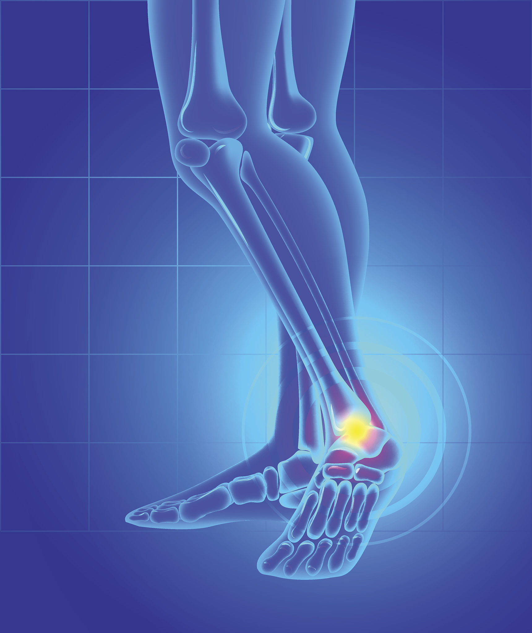 骨坏死的话会随着时间加剧吗