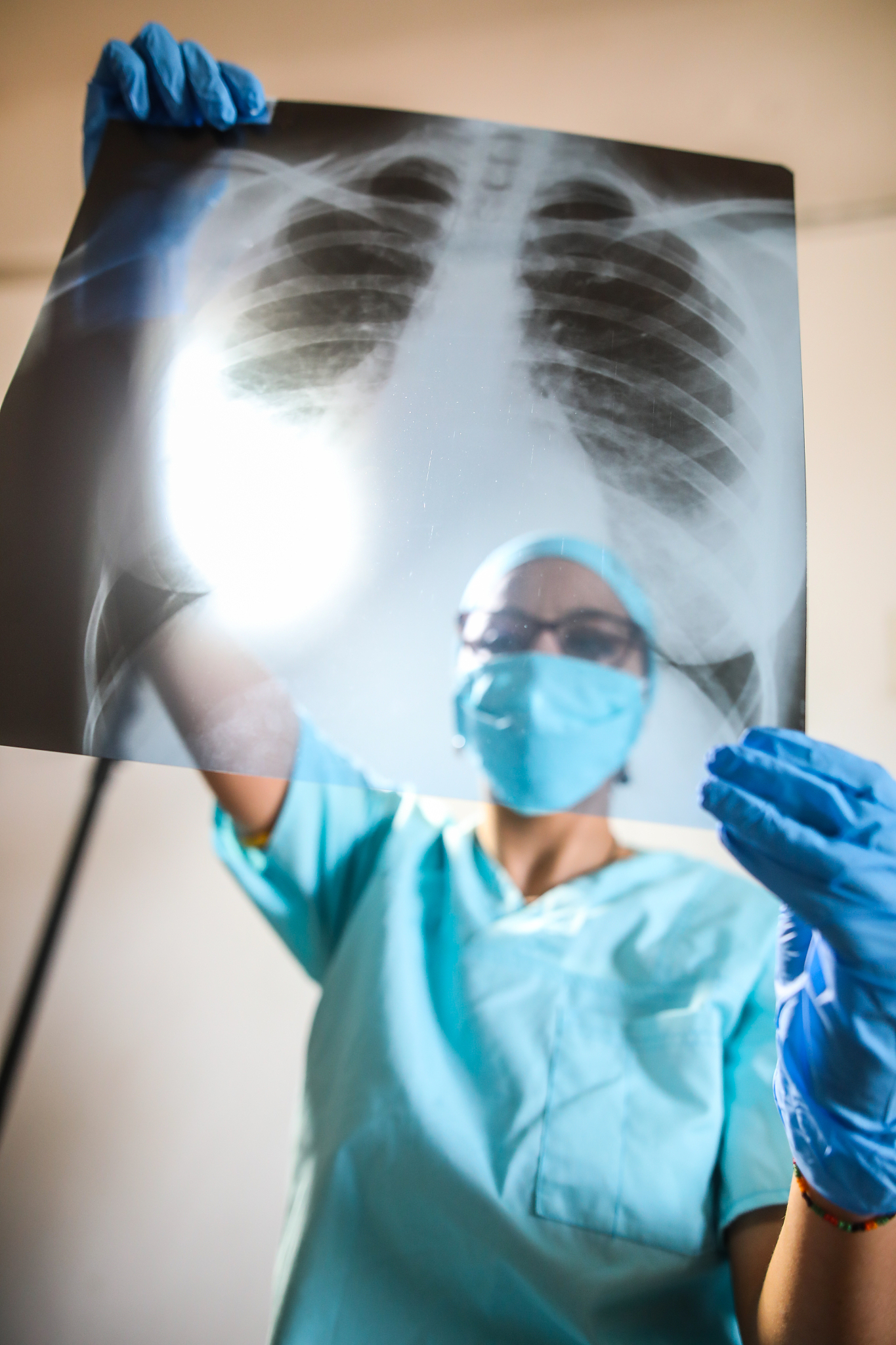 肺癌治疗方法有哪些？手术、放疗、化疗、靶向、免疫、中药全面解析