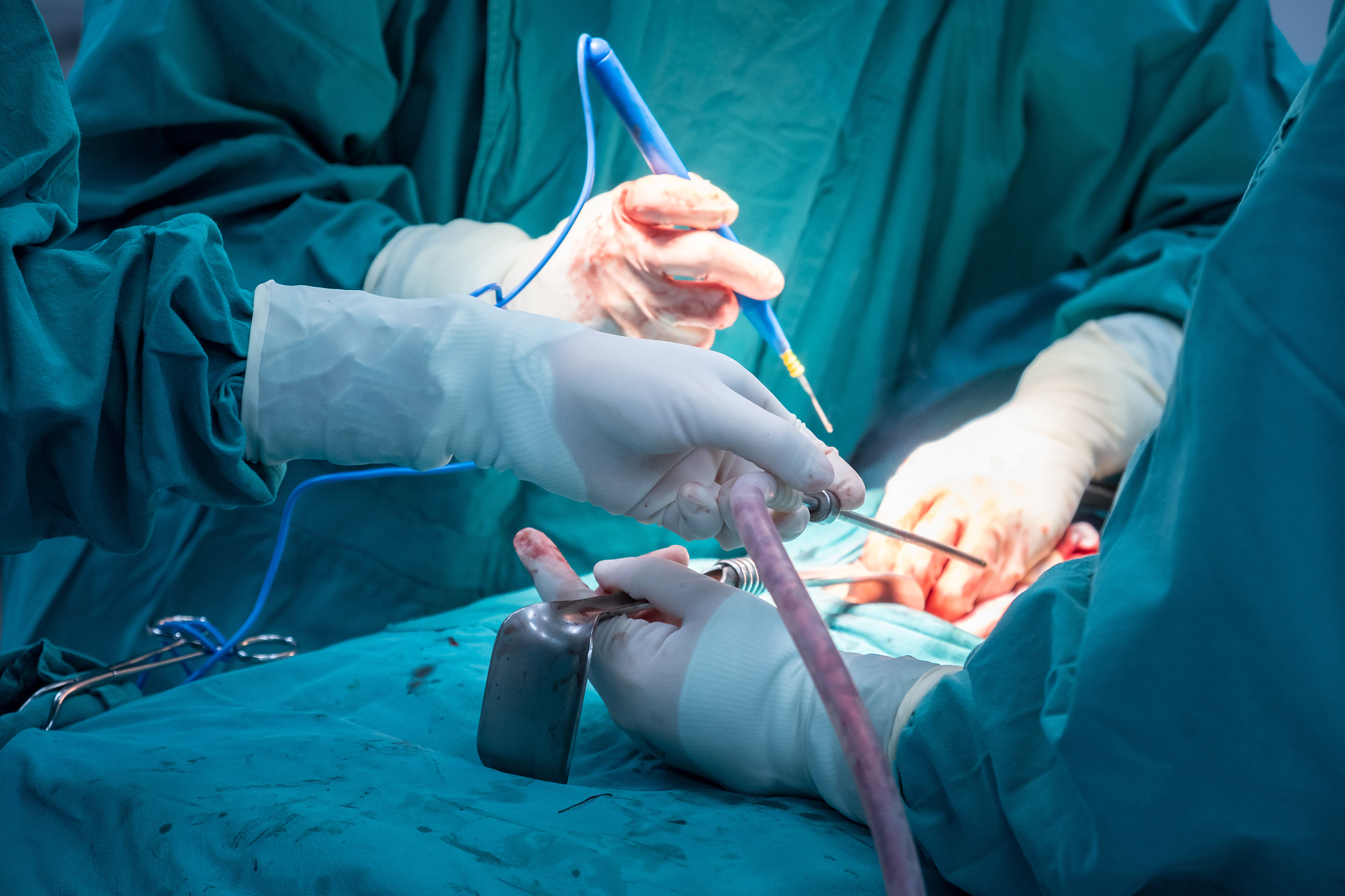 cropped shot of medical team performing surgical operation in op