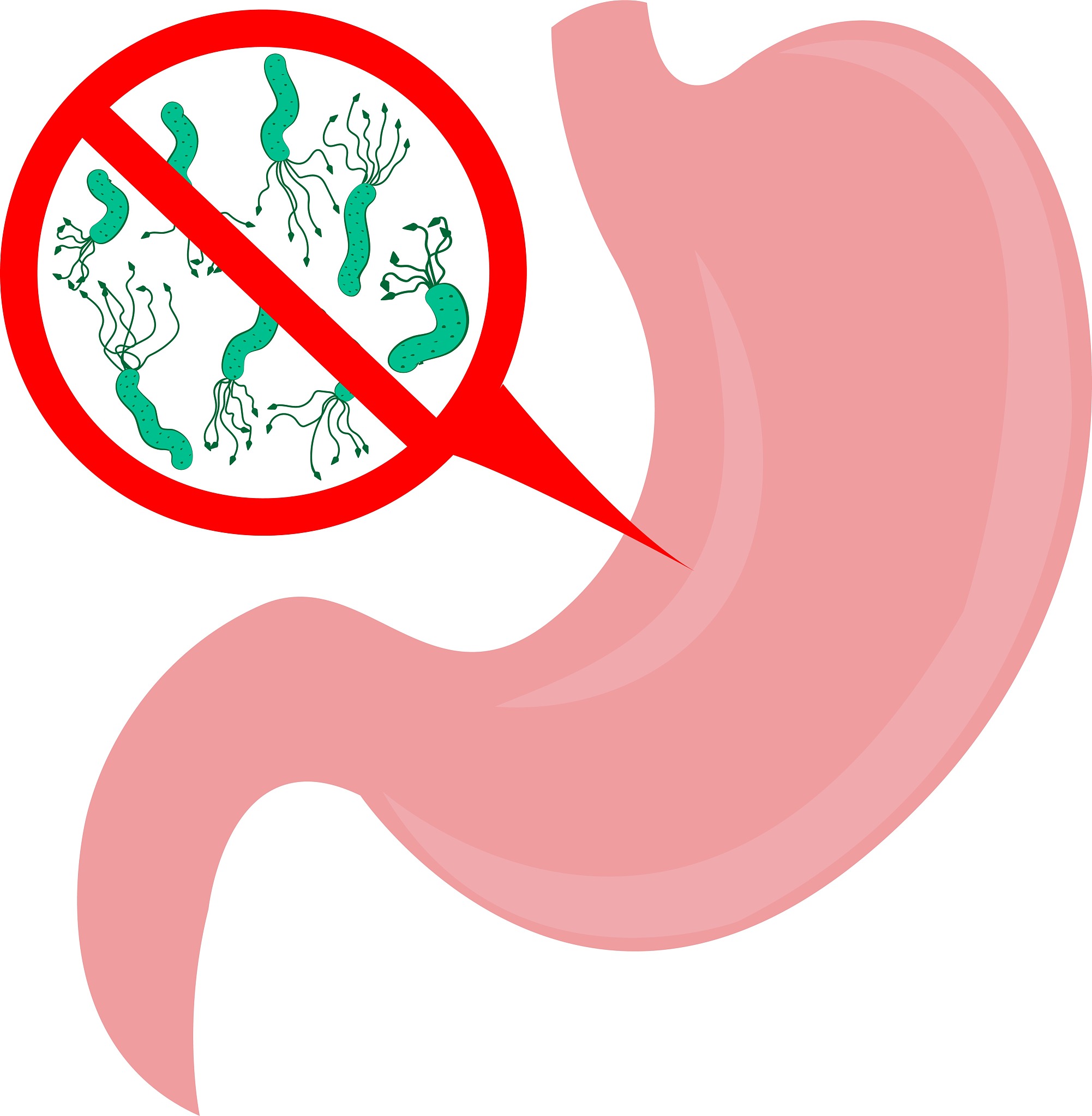 幽门螺旋杆菌感染：该根治吗？一半中国人感染，你可能毫不知情！