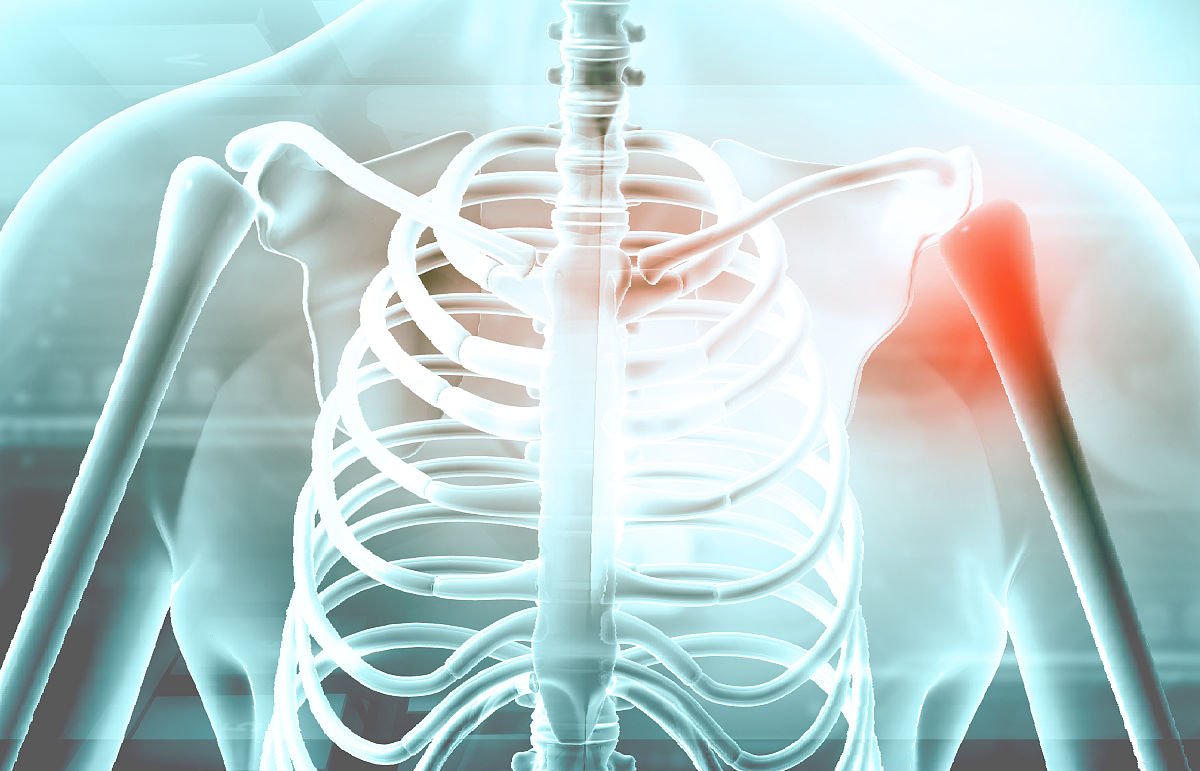 关节松动术治疗脑卒中后肩痛的优势