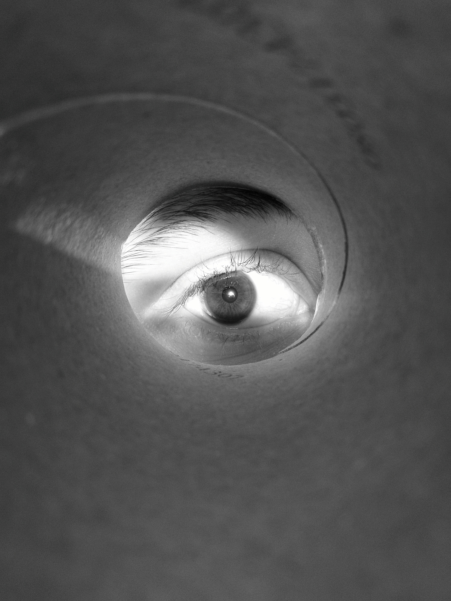 视网膜轻度脱落症状