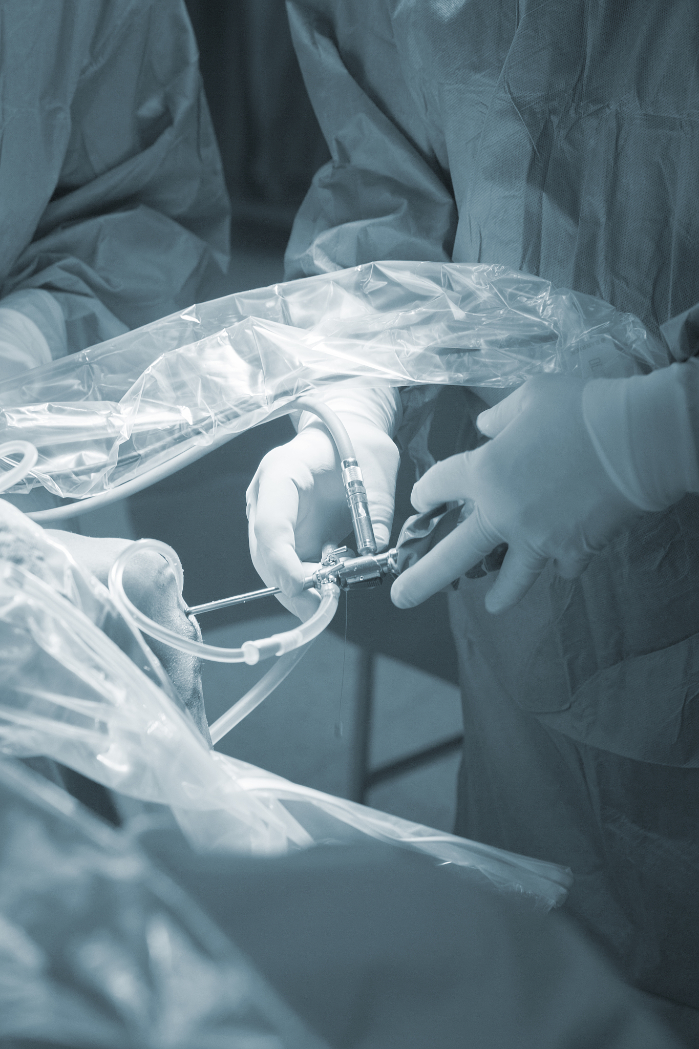knee keyhole surgery hospital arthroscopy operation medical proc