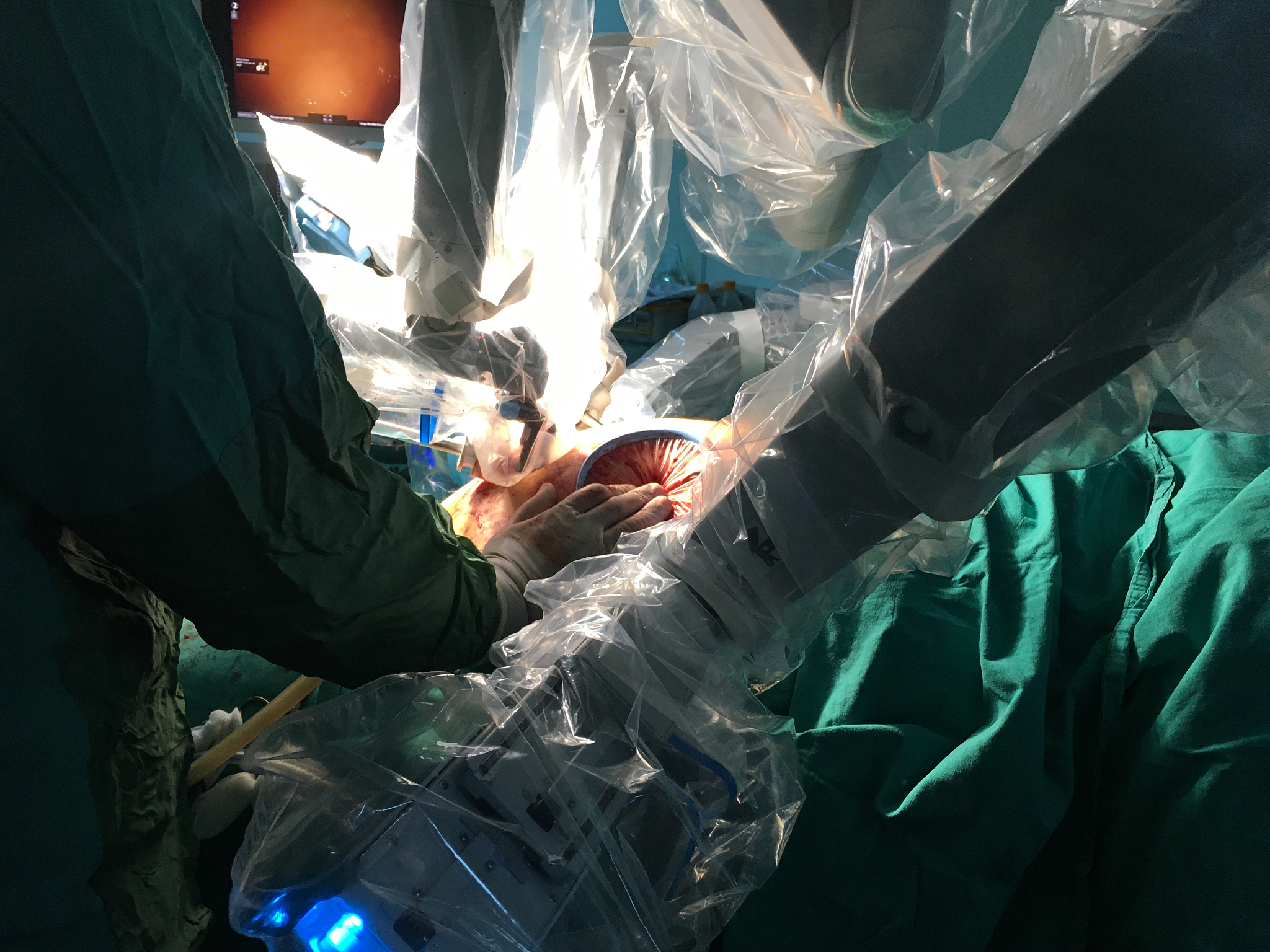 光伏焊带的关键生产技术