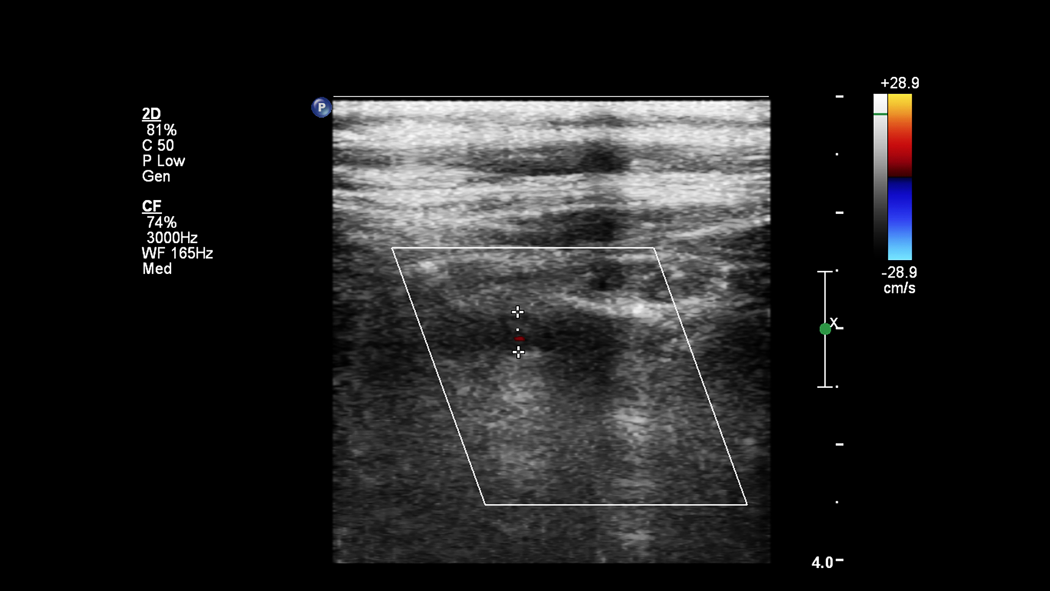 超声三级和四级手术权限