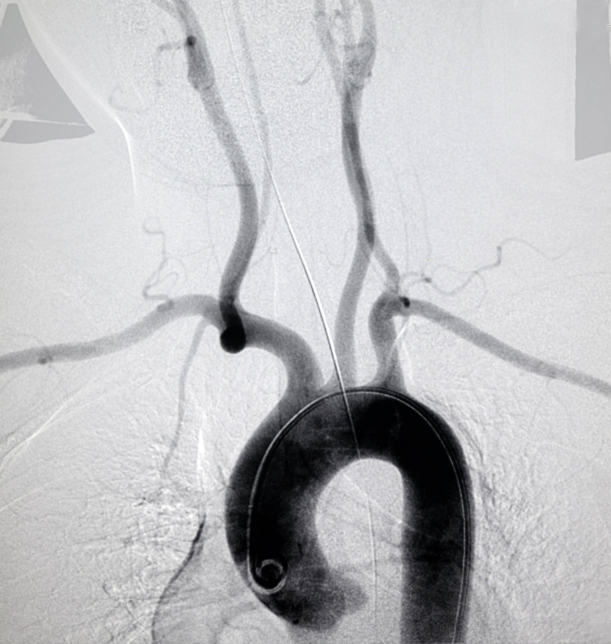 新建一栋心血管病诊疗中心大楼地下2层地上10层包含：医疗净化区、病房区、办公区有DSA、ICU、CCU、直升机停机坪从项目的特点、前期的考察、设计方案、建设过程中的管理不足站在建设单位的角度进行总结写一篇医院类项目建设管理经验要求5000字