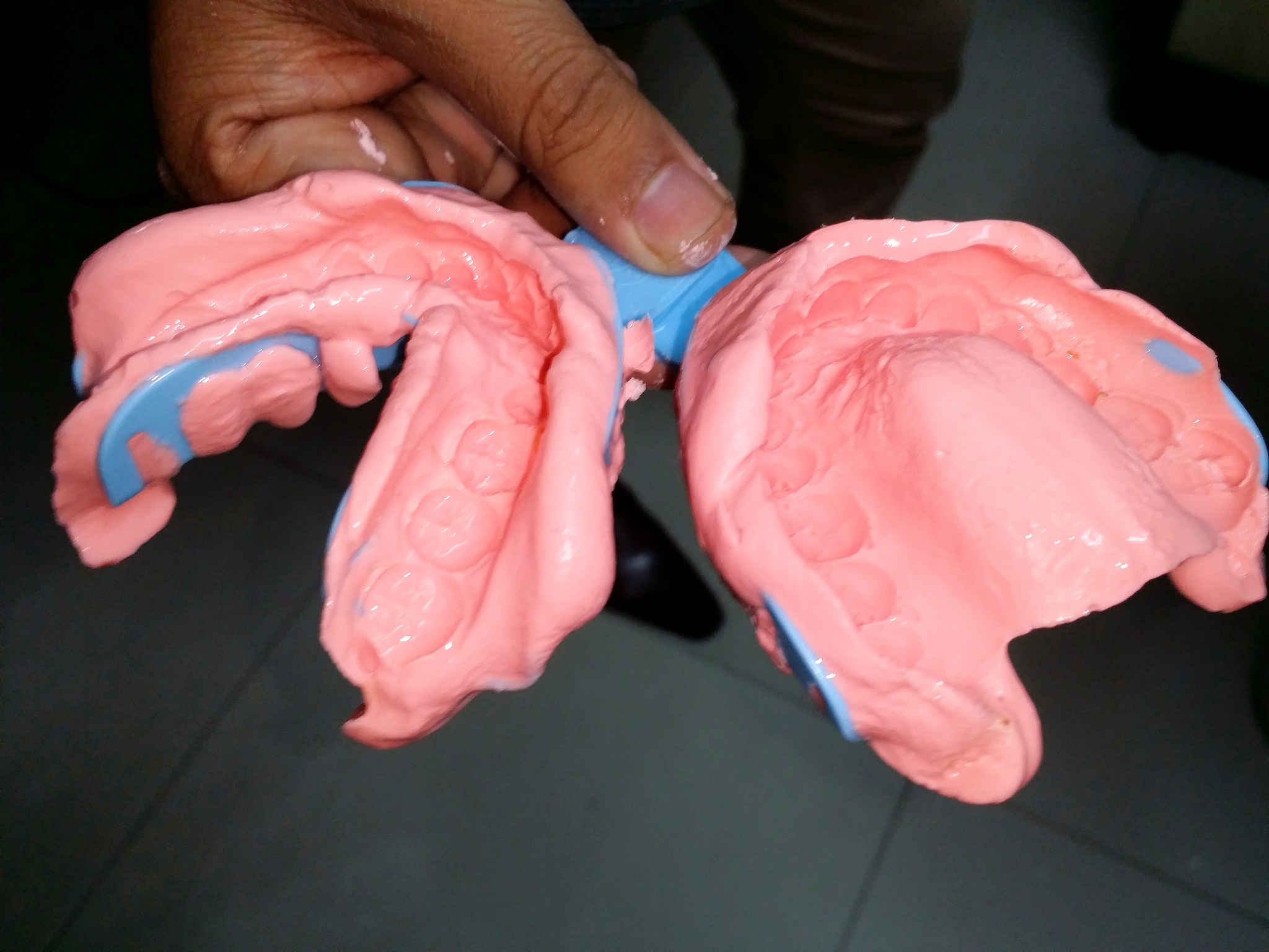 漳州卫生职业学院口腔医学技术专业就业前景分析 - 未来发展方向