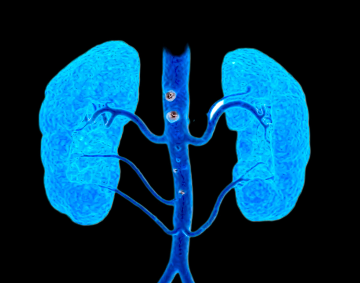 钆造影剂对于肾脏肝脏的损害是？