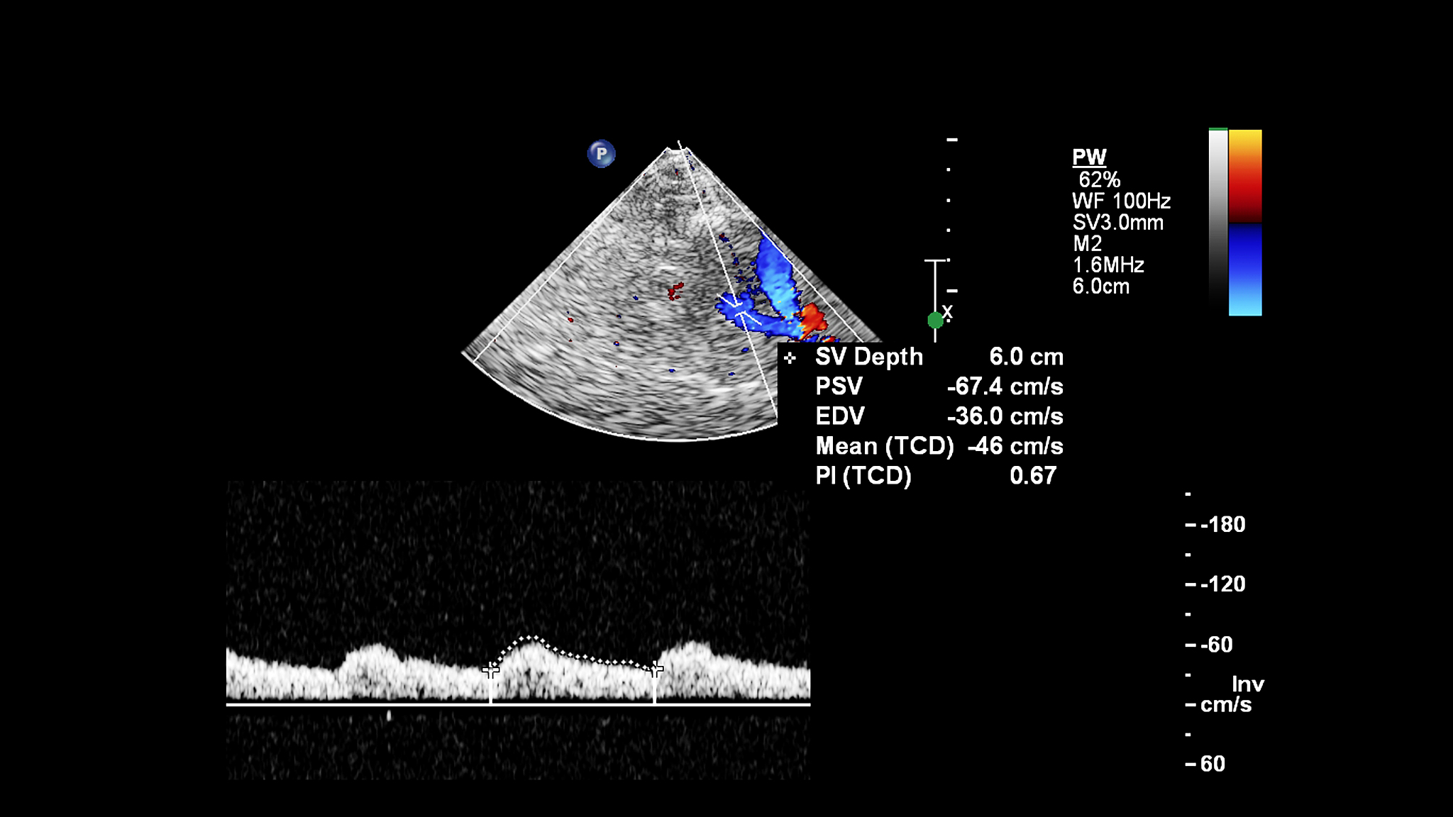 YJK、MIDAS和ABAQUS软件计算结果对比分析
