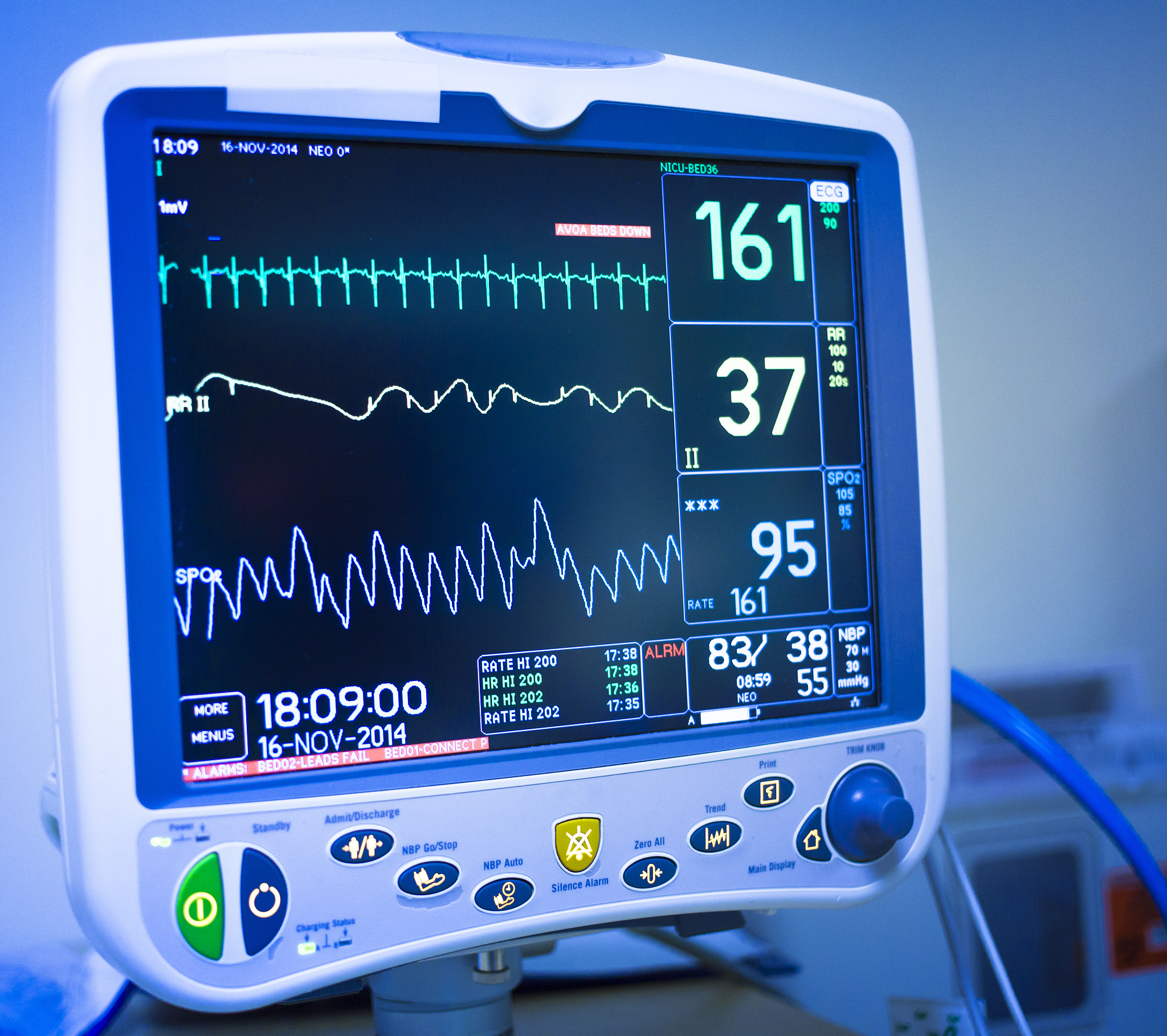 自发性液气胸体征监测护理：保障患者安全