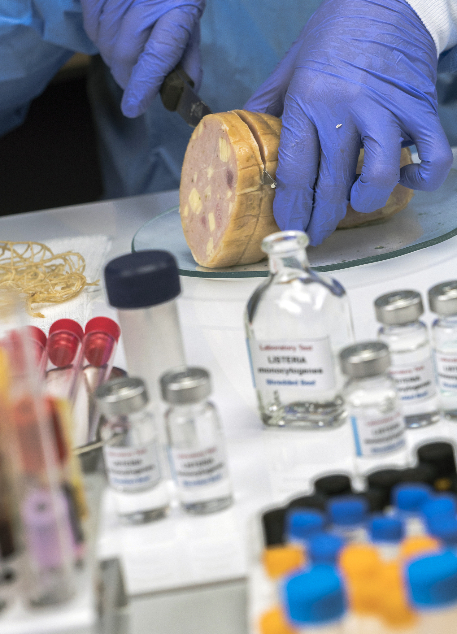 铜绿假单胞菌肺炎治疗方法：抗生素、支持性治疗、外科手术及预防