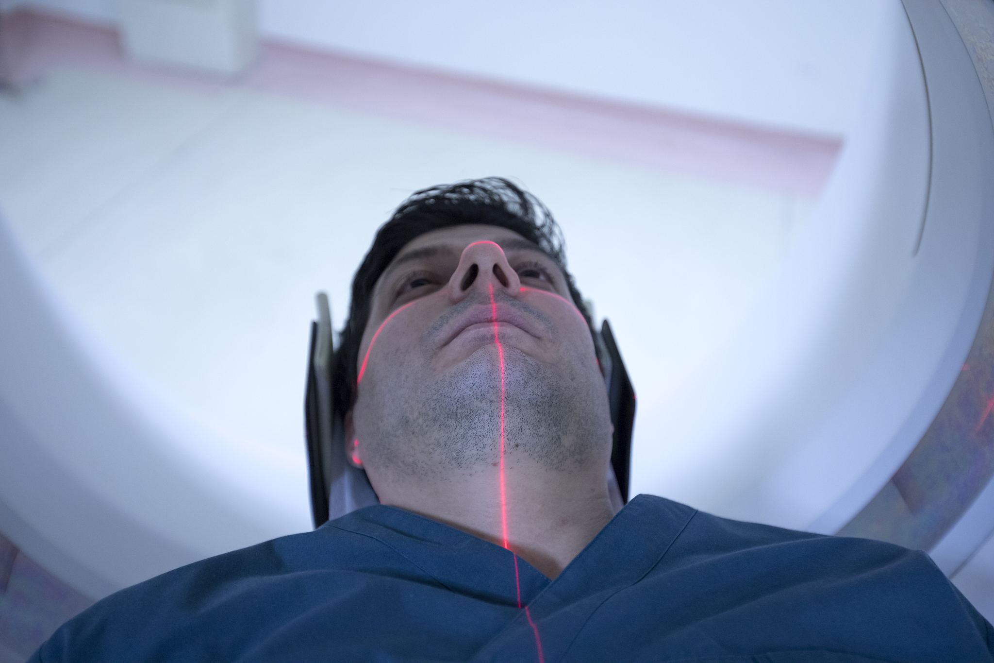 趴着午睡后眼睛模糊？原因及解决方法