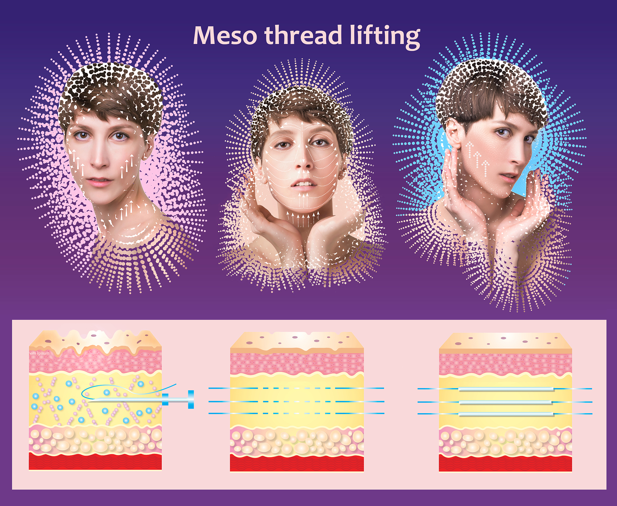 除皱朋友圈爆款标题