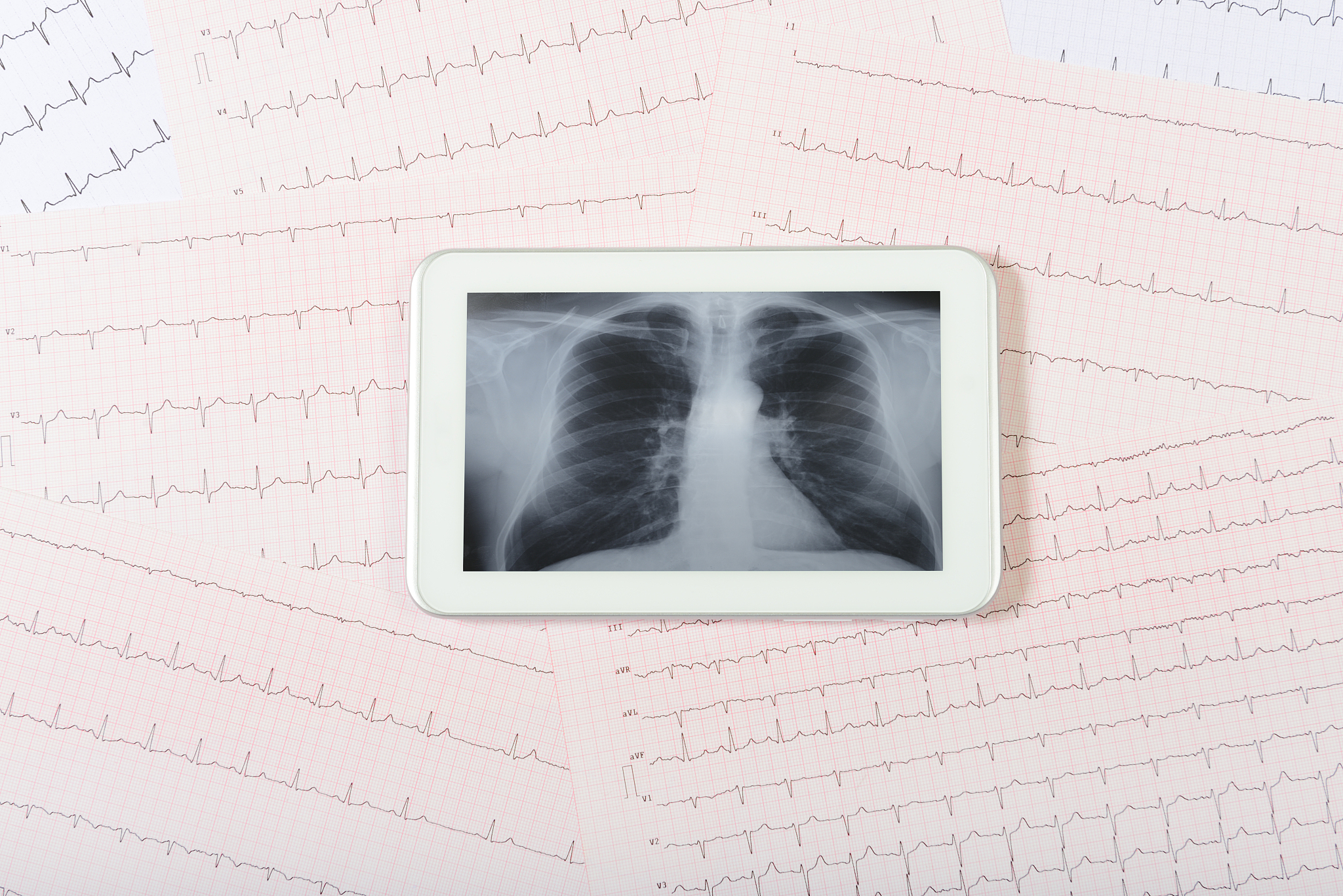 动车保洁入职体检需要检查哪些项目