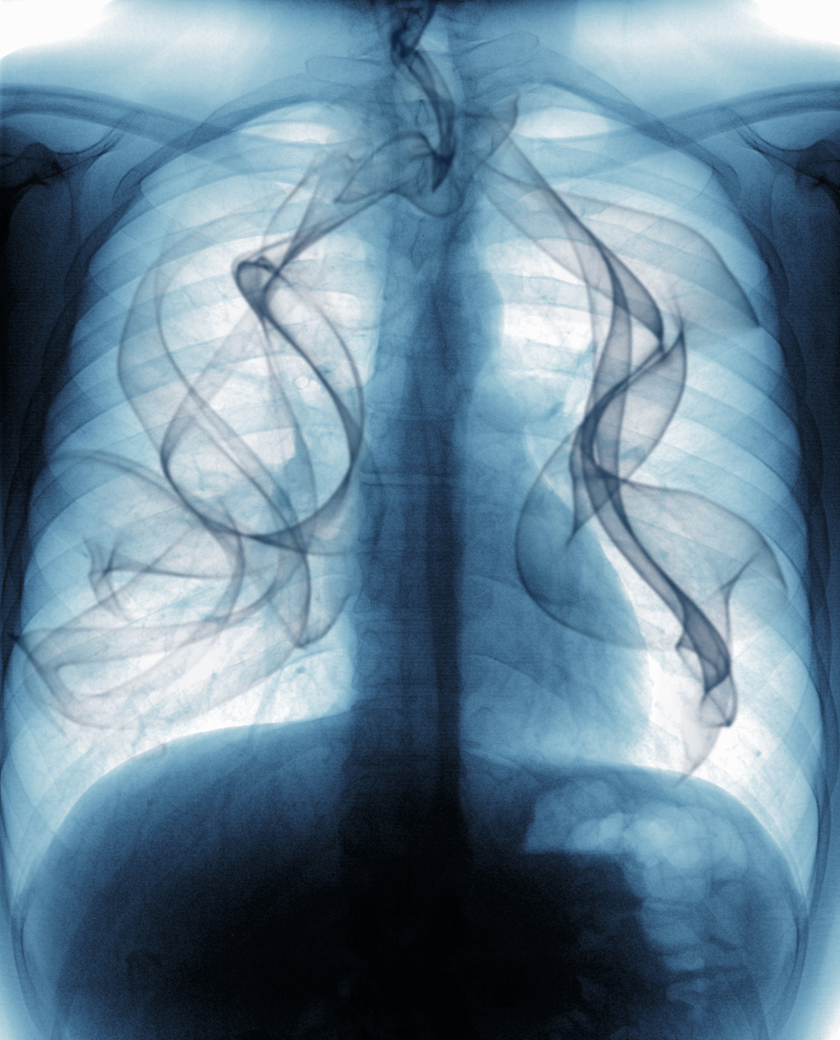 上海肺科医院：肺部疾病治疗的信赖之选