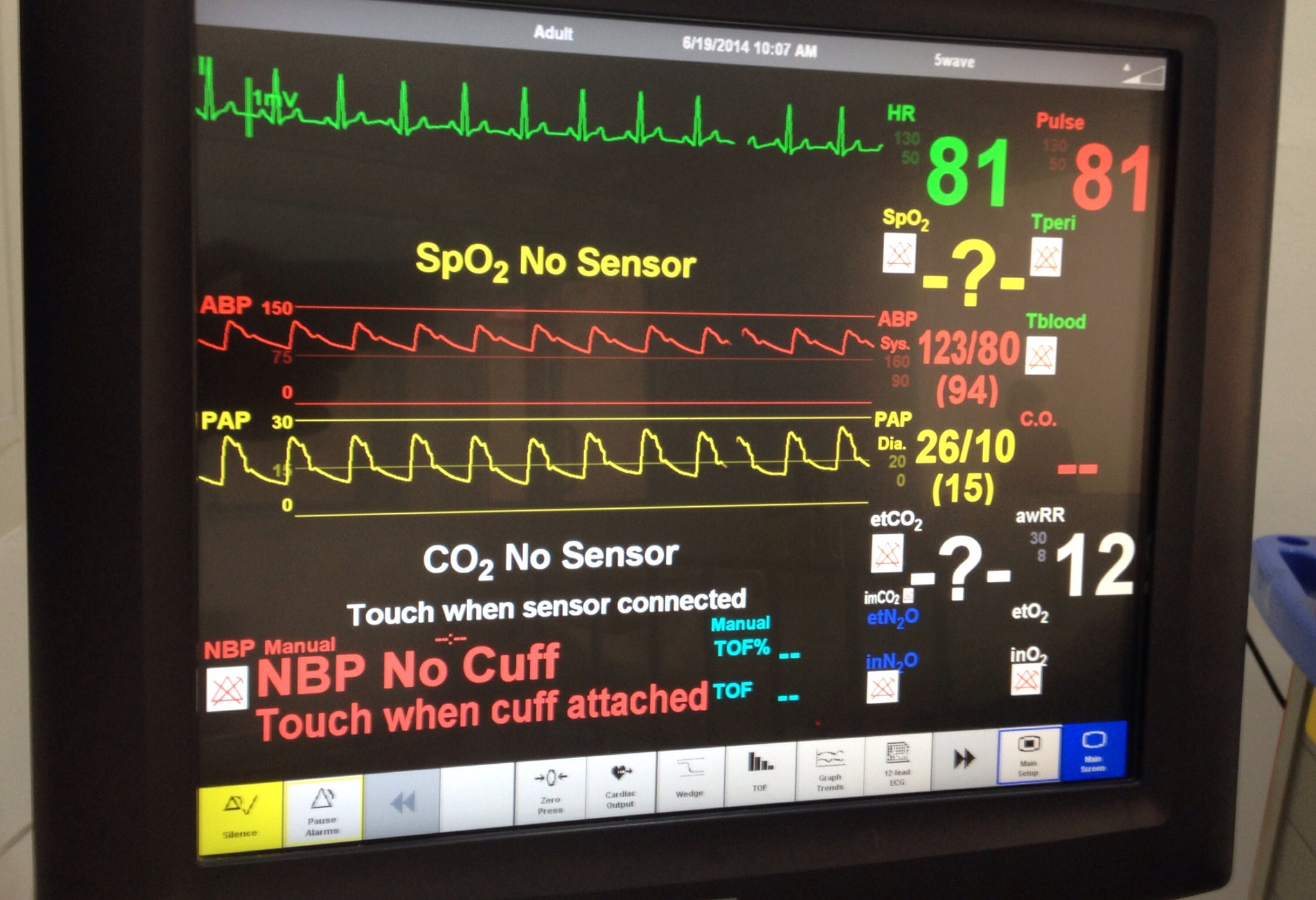 胎心监护仪中央站数据格式：CSV、XML、JSON、HL7、DICOM