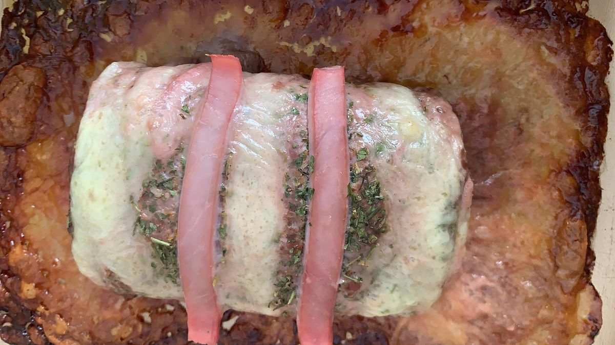 腹膜后脂肪肉瘤研究综述