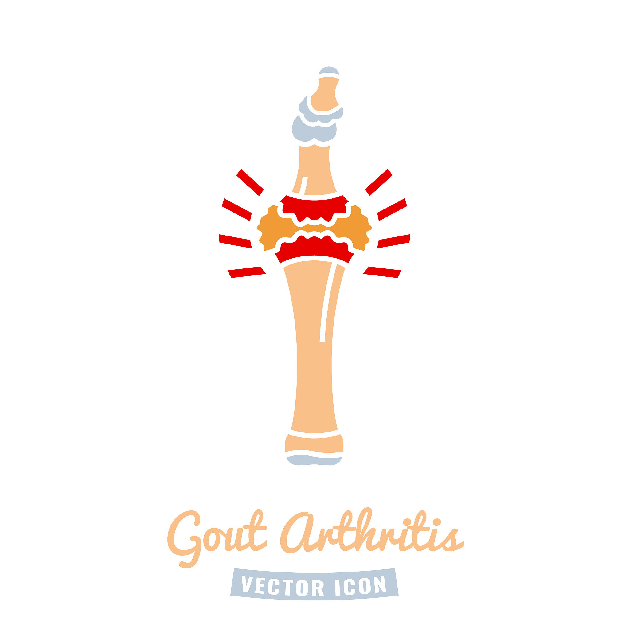 痛风为什么会导致尿酸在关节中形成结晶？损害关节组织和造成疼痛。各方面说说看。