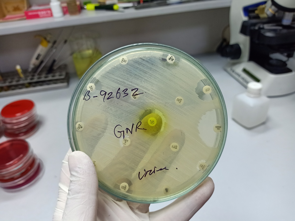 平板菌落集中生长原因分析