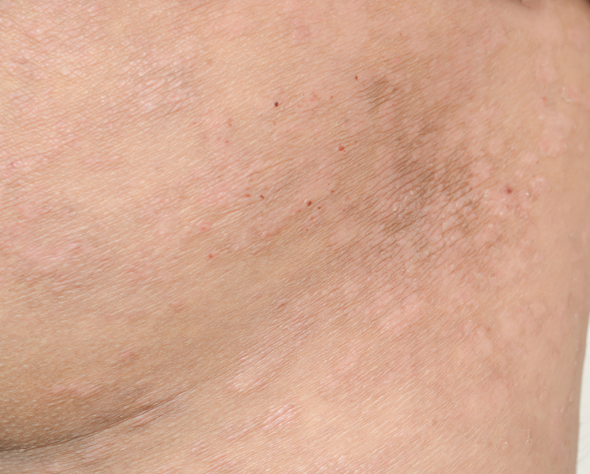 手臂上白色物体：常见原因及诊疗建议